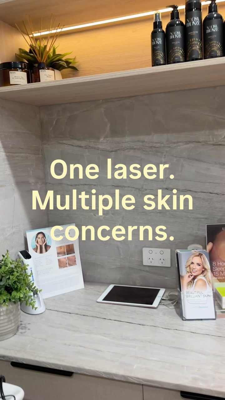 Your skin isn’t one-size-fits-all and your treatment shouldn’t be either.
Our treatments are customised to your skin, your concerns and the results you want to achieve.
Whether you’re looking to:
• Reduce redness & visible capillaries
• Target pigmentation
• Improve skin texture & scarring
• Refine pores
• Stimulate collagen & firmness
• Restore healthier, more radiant skin
We’ll assess your skin and create a treatment approach that’s right for you.
Ready to start your skin journey?
📲 Book your consultation online — link in bio.
ABOUT FACES NOOSA
Personalised treatment. Experienced hands. Real skin. Real results.
