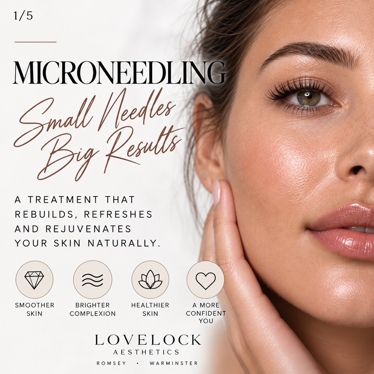 ✨ SMALL NEEDLES. BIG SKIN ENERGY. ✨
If your skin is feeling a little meh, microneedling might just be the wake-up call it needs. 👀
Microneedling works by stimulating your skin’s natural repair response, encouraging the production of collagen and elastin — basically, getting your skin to do more of the good stuff itself. 🙌🏼
It can help to:
✨ Improve skin texture
✨ Soften the appearance of fine lines
✨ Reduce the appearance of enlarged pores
✨ Improve certain acne scars
✨ Promote firmer, smoother-looking skin
✨ Improve uneven-looking skin tone
✨ Bring back that healthy, natural GLOW
And the best bit? We’re improving your skin, not changing your face. 🤍
Healthy skin is always in. ✨
📍 Lovelock Aesthetics — Romsey & Warminster
🏆 National Beauty Award Winner
🎓 Level 7 Expert Practitioner
#Microneedling #MicroneedlingUK #SkinRejuvenation #CollagenBoost #LovelockAesthetics