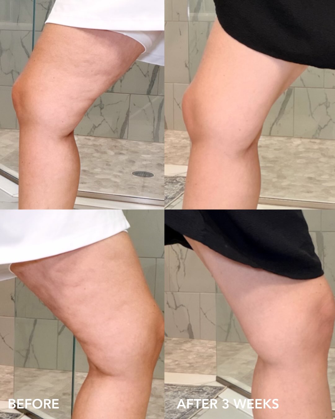September deal: Get 20% off VOL.U.LIFT BODY! This body lotion is a clinical sculpt & firm complex, formulated by a plastic surgeon to address the body skin changes that come with GLP-1/GIP use: sagging, crepiness, dehydration, and loss of tone.
Powered by Marine Bioactive, Heptapeptide-7, Bakuchiol, HA Silanol, and our proprietary XOSM® Technology, this multi-benefit formula works to sculpt, firm, hydrate, and smooth, targeting the abdomen, arms, thighs, and buttocks. Amplify your in-office sculpting results, or use it as a standalone treatment.
Stop by Tighter Lines to grab your VOL.U.LIFT BODY 👉 1102 W Indiantown Rd Ste 7, Jupiter, FL