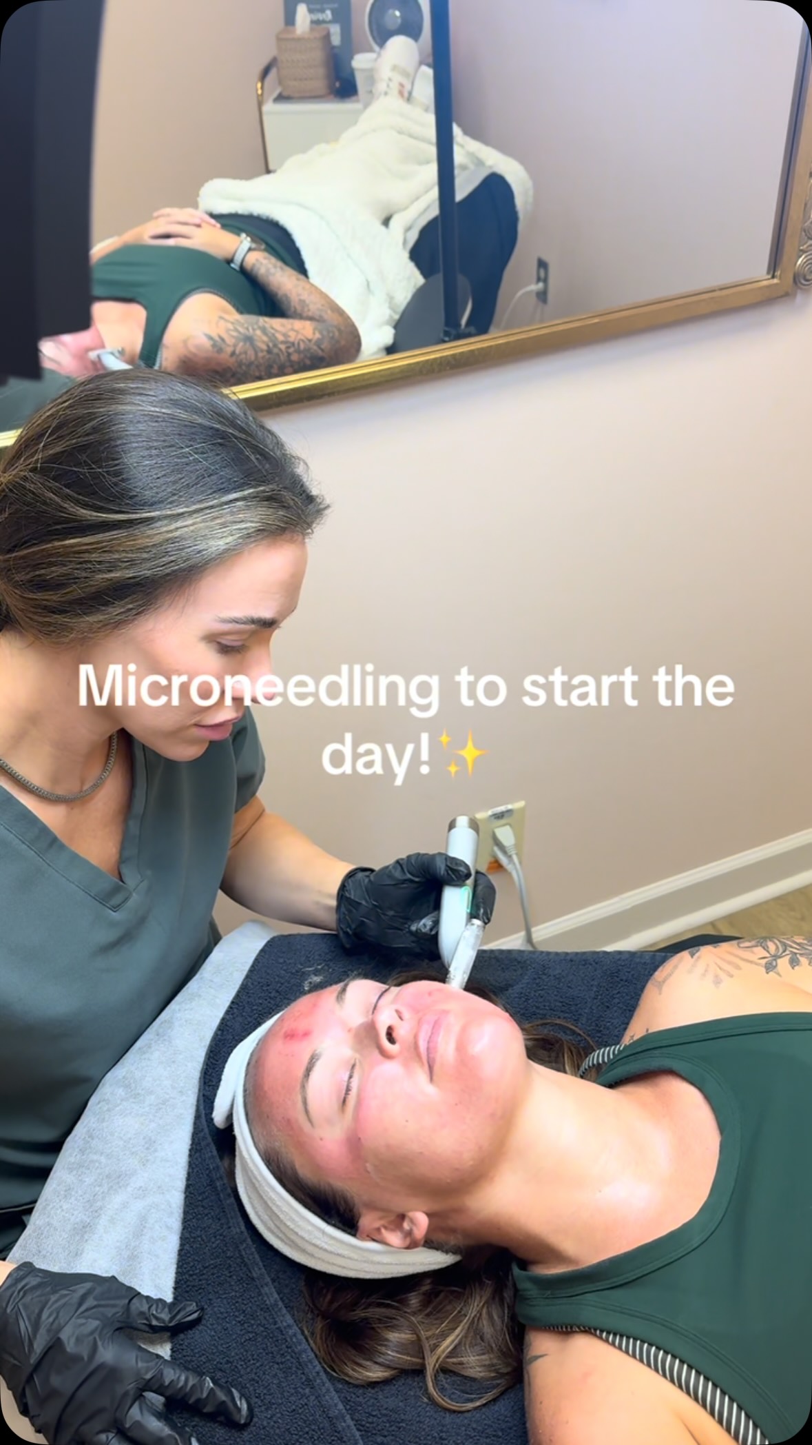 Microneedling for some glow✨