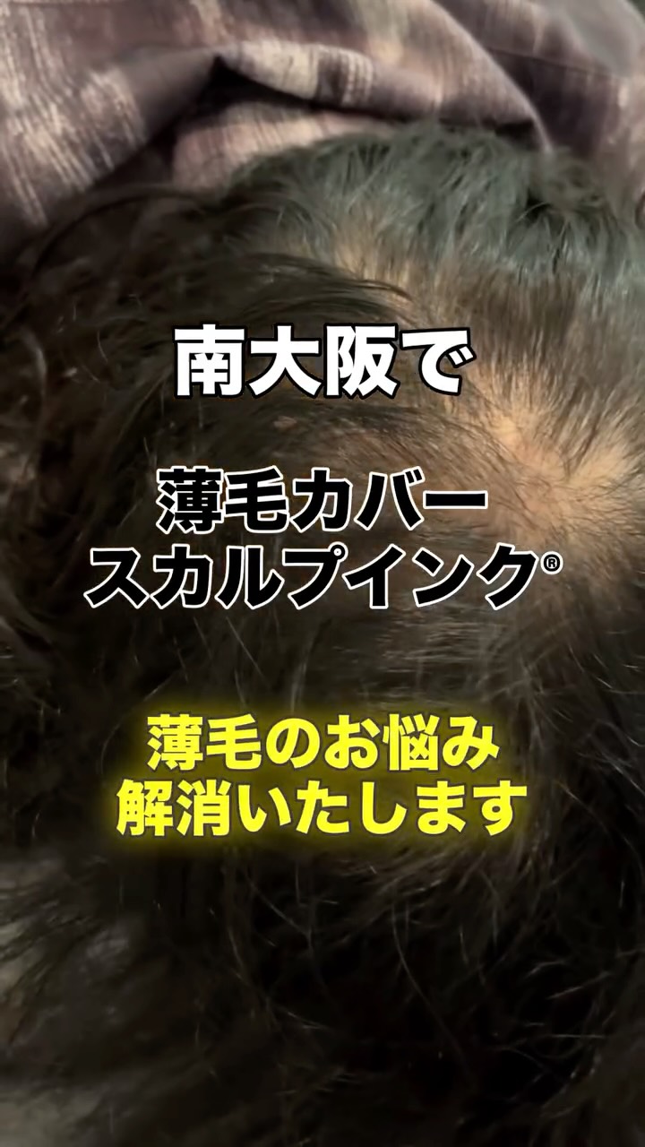 その薄毛、まずは“スカルプインク®“が自分に合うのか、から試しませんか?
当店では、皆様に安心して試していただけますように。初回施術で定着適性を見極め、万が一合わない場合は半額返金保証いたします。
無理に続けさせることはありません。結果に自信があるから、この仕組みです。
👉まずは“あなたに合うか”を確認してください。
【初回適正診断保証(半額返金)】
初回施術後、頭皮状態や色素の定着を確認し、当店基準で継続が難しいと判断した場合、初回施術費用の半額を返金いたします。
※以下の場合は対象外
・当店が継続可能と判断した場合
・お客様都合による中断など
・デザインの好みによる不満など
・アフターケア未実施など
──────────────────────
髪が薄くなると、見た目だけでなく気分まで沈みがち。
でも、もう一人で悩まなくて大丈夫です。
前髪・つむじ・分け目。
どこから見られても怖くない自然な仕上がりへ。
スカルプインク®は極小ドットで濃さを再現する
“最もバレにくい”頭皮タトゥー技術。
・痛みほぼなし/麻酔不要
・色落ちしにくい専用インク
・即日変化を実感/男女対応
産後脱毛・円形脱毛・傷跡にも対応。
──────────────────────
※美容師歴20数年の認定アーティストが責任を持って施術します。
※この地で開業18年となります、ご安心してお任せください。
大阪・和泉市|THREE BRANCHES
✨今なら3.3万発
49500円が33,000円(税込)
今なら何度でも‼️
📩公式LINEでご相談ください。
#スカルプインク
#薄毛対策
#SMP大阪
#スカルプインク大阪
#頭皮タトゥー大阪
※大阪で薄毛で悩まれている男性も女性も
ぜひ1度お声掛けください。