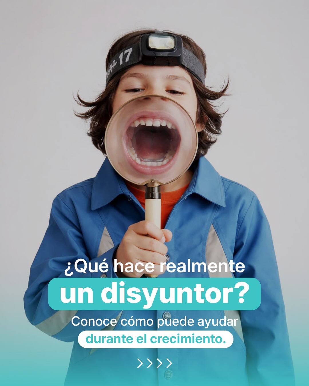 🦷 ¿Sabías que algunos malos hábitos pueden afectar el desarrollo de los maxilares?
La respiración bucal, la posición baja de la lengua, la deglución atípica o una masticación poco eficiente pueden favorecer un maxilar superior estrecho, falta de espacio para la correcta ubicación de los dientes y diferentes maloclusiones.
Cuando existe un maxilar estrecho, el disyuntor puede ayudarnos a ampliarlo y orientar su desarrollo, aprovechando el período de crecimiento del niño. 👧🏻👦🏻✨
Por eso, no solo observamos los dientes: también evaluamos cómo respira, mastica y traga cada paciente.
🔍 Detectar y tratar tempranamente estos hábitos puede marcar una gran diferencia en su desarrollo dentomaxilofacial.
¿Tu hijo respira por la boca, duerme con la boca abierta o presenta poco espacio para sus dientes? Agenda una evaluación. 💙
📍Dentsalud, Viña del Mar
#RespiraciónBucal #Disyuntor #MalosHábitosOrales #OrtopediaDentomaxilofacial #OrtodonciaInfantil DesarrolloMaxilar Maloclusión DiagnósticoPrecoz Dentsalud ViñaDelMar
