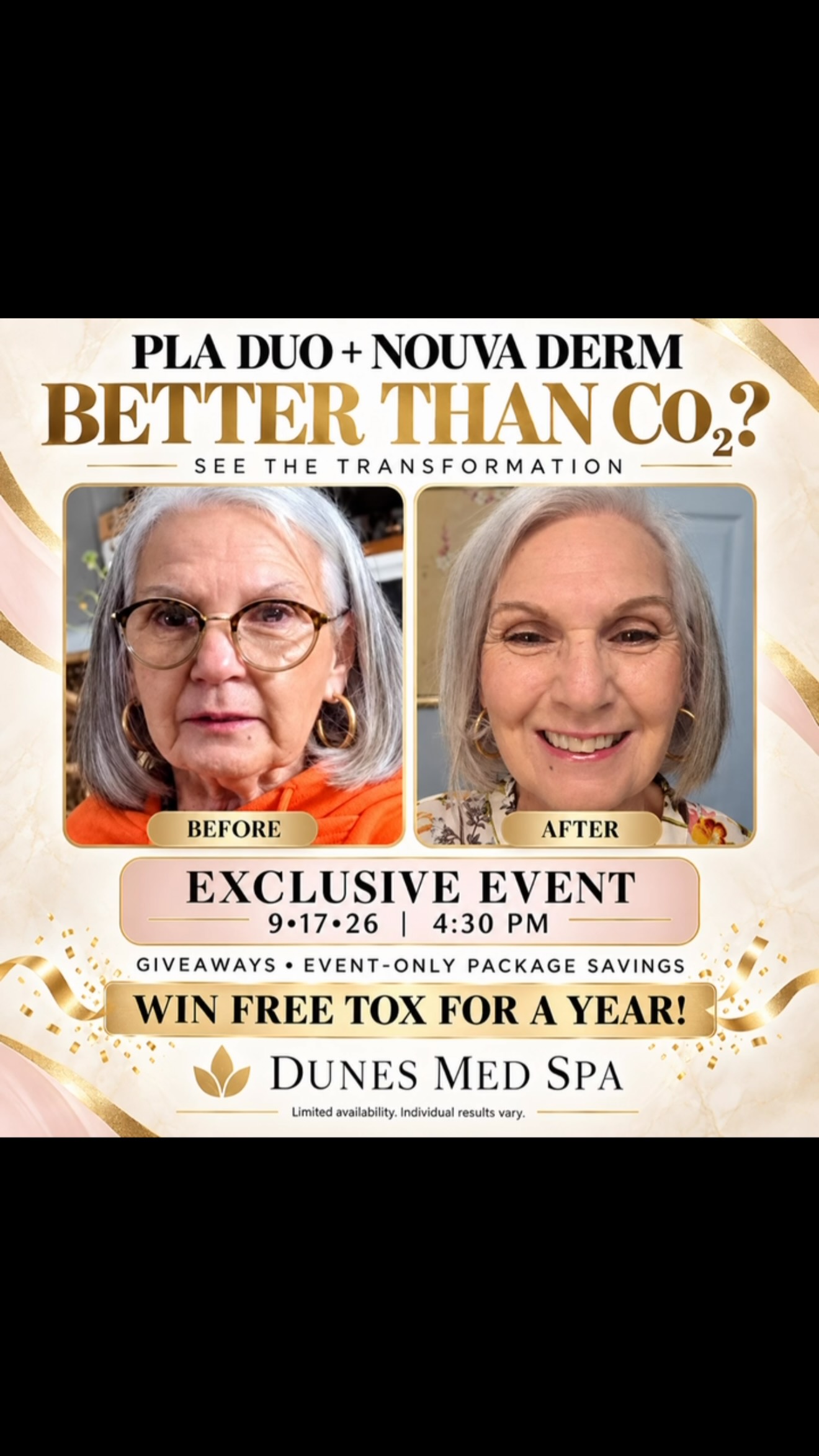 🔥 Is this BETTER THAN CO₂? Look at this transformation! 🔥
Meet the future of skin rejuvenation with PlaDuo + NouvaDerm—designed to improve the appearance of wrinkles, texture, tone and skin laxity with less downtime than traditional CO₂ treatments. ✨
🥂 EXCLUSIVE EVENT
📅 September 17, 2026
⏰ 4:30 PM
📍 Dunes Med Spa
🎁 Giveaways
📦 Event-only package savings
💉 Enter to WIN FREE TOX FOR AN ENTIRE YEAR!
Spots and event packages will be limited! Comment GLOW below or text 843-418-4422 to reserve your place. Tag the friend who needs to come with you! 👯♀️✨
Individual results vary. Consultation required.
#DunesMedSpa #MyrtleBeachMedSpa #PlaDuo #NouvaDerm #SkinRejuvenation SkinResurfacing AntiAging MyrtleBeachSC MedSpaEvent GlowUp
