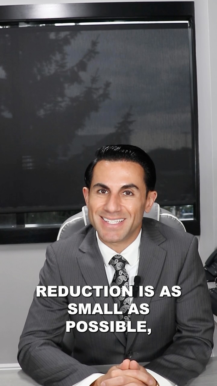 Can you go “too small” with a breast reduction? Technically, yes.
There are limits to how much tissue can safely be removed while maintaining healthy blood supply to the nipple-areolar complex. The goal is always to reduce the breasts as safely possible while still creating a result that fits the patient’s anatomy and goals.
That’s why this conversation starts well before surgery.
#njplasticsurgeon #nouriplasticsurgery #paramusplasticsurgeon #nourips #éducation