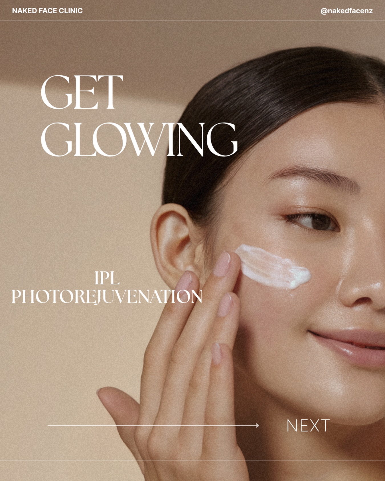 ✨ IPL PHOTO REJUVENATION ✨
Ready to bring back your skin’s natural glow? 🤍
IPL Photo Rejuvenation is a non-invasive skin treatment designed to improve the appearance of sun damage, pigmentation, redness, uneven skin tone and visible signs of ageing — leaving your skin looking fresher, brighter and more even.
✨ Helps reduce the appearance of pigmentation & sun spots
✨ Targets redness and uneven skin tone
✨ Helps improve overall skin clarity
✨ Stimulates collagen for smoother-looking skin
✨ Minimal downtime for most clients
Think of it as a skin reset — revealing a clearer, more radiant complexion over a course of treatments.
📸 Before & afters can be subtle at first, but the cumulative results can be beautiful.
💫 Want to know if IPL is right for your skin?
Book a consultation with us and we’ll create a treatment plan tailored to your skin goals.
📍 Naked Face Clinic
📲 DM us or book online
#NakedFaceClinic #botoxwellington #photorejuvenation #skinwellington