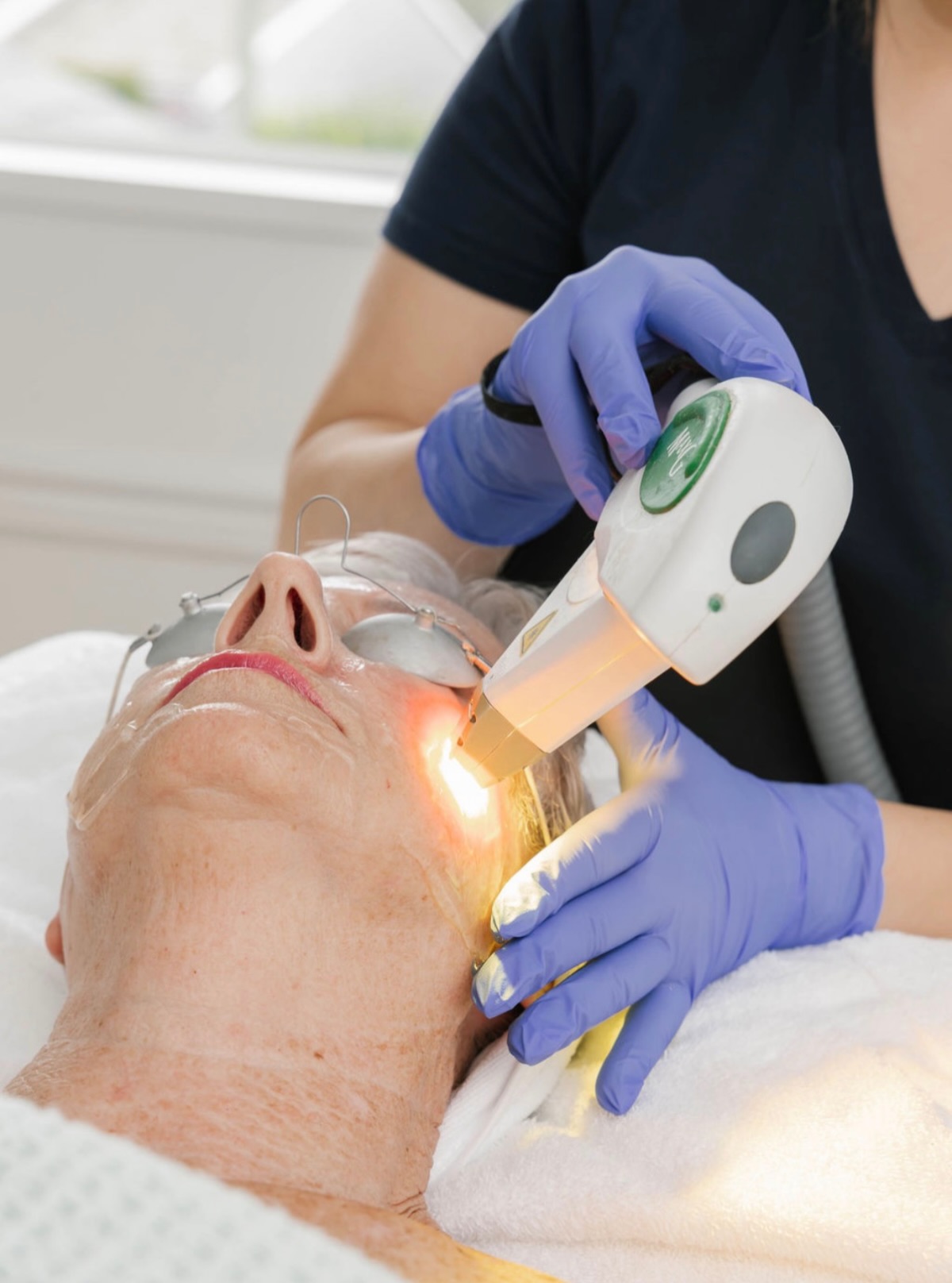 MaxG IPL uses targeted pulses of light that are absorbed by melanin in unwanted pigmentation and hemoglobin within visible blood vessels. That light energy is converted to heat, helping reduce the appearance of concerns like sun damage, brown spots, redness and visible vessels while leaving the skin’s surface intact.
Because different skin concerns require different treatment parameters, each MaxG IPL treatment at View Laser is customized based on your skin and individual goals.
And September is the perfect time to start your series:
Buy 3 MaxG IPL treatments + receive your 4th FREE
$1,200 package - Regularly $1,600
Available until September 30th.
📧 reception@viewlaser.com
💻 viewlaser.com
#pigment #skinrejuvenation #delta #tsawwassen