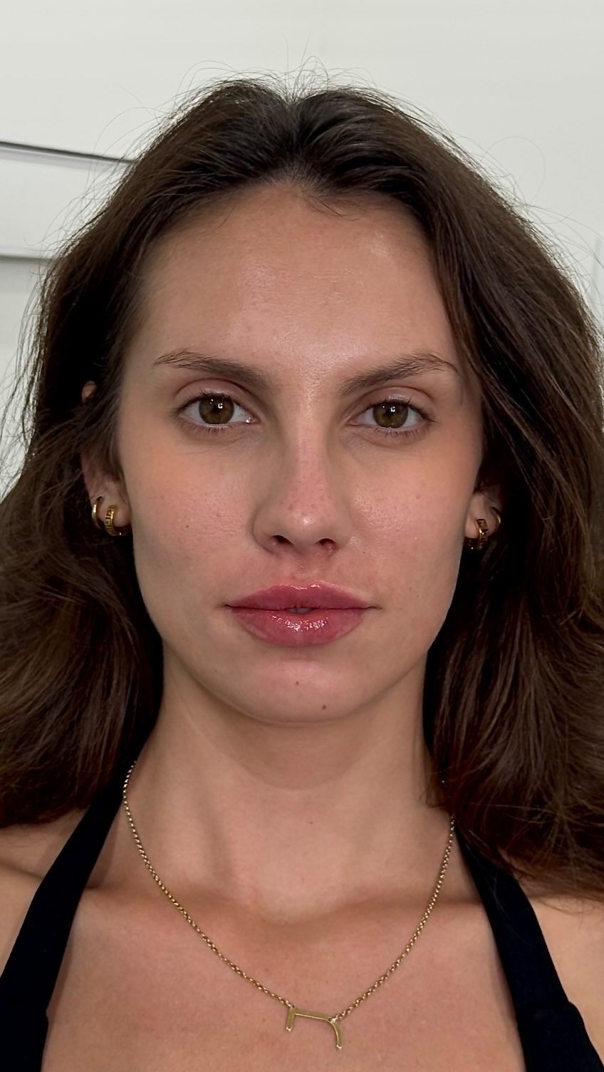 Soft, balanced, and beautifully enhanced 💋
This lip filler treatment added natural-looking volume and definition while complementing her unique lip shape. Every treatment is carefully customized because the best results still look like you, just refreshed
Treatment: Lip filler using hyaluronic acid.
Treatment performed by Nurse Shay Bloo, RPN | Aesthetic Nurse Injector.
Care provided with an authorized prescriber involved as part of our clinical team. Learn more about our clinical team at @purebeauty.cln.
For more information:
📞 343-227-6945
📧 info@purebeauty.clinic
🔗 Booking link in bio for more information
Photos and video were taken immediately after treatment. Temporary redness and swelling may be present and generally subside as the area heals. Final results are assessed approximately two weeks after treatment. Individual experiences and results may vary.