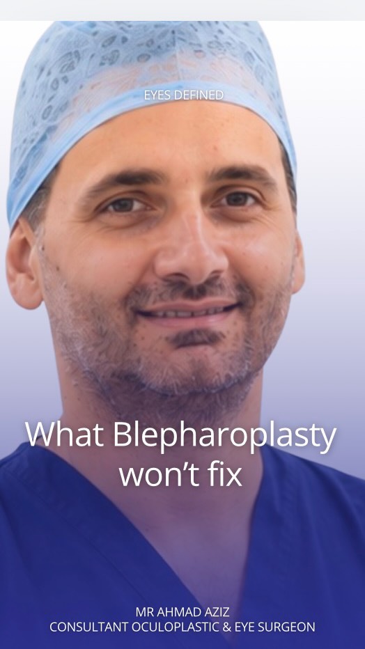 Thinking about lower eyelid blepharoplasty? 🧐 Sometimes, less is more. In this video, I explain when NOT to go ahead with surgery — and why it's crucial to choose the right solution for your eyes, not just the most popular one. 👁️✨ #TrustTheExpert
#OculoplasticSurgeon #LondonSurgeon #LowerBlepharoplasty #EyelidSurgery #UnderEyeBags #BlepharoplastyAdvice #CosmeticSurgeryLondon #EyelidHealth #FacialAesthetics #NaturalResults #SurgicalAwareness #KnowBeforeYouGo