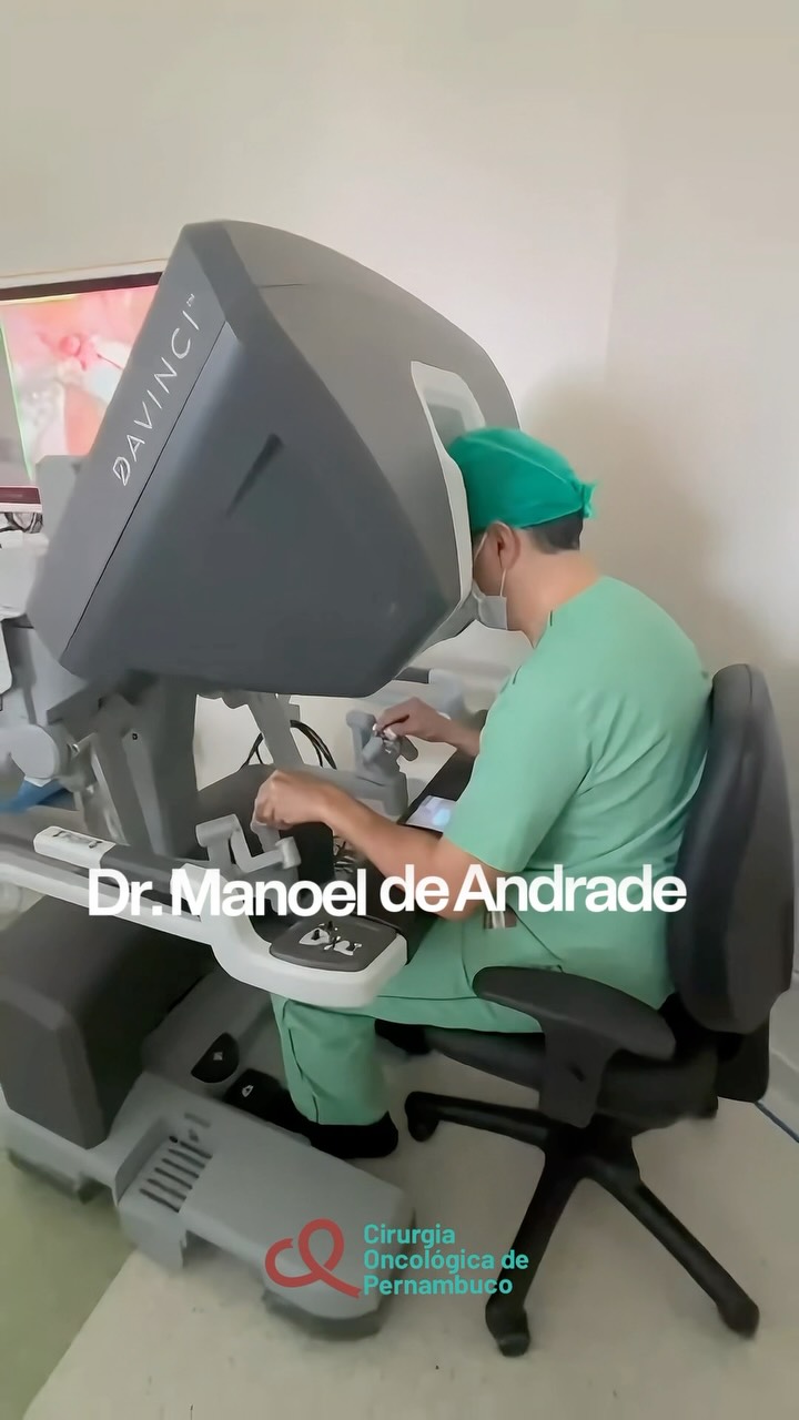 Dr. Manoel de Andrade em procedimento de cirurgia robótica para tratamento de tumor no ovário esquerdo, com avaliação dos gânglios para o estadiamento.
O procedimento contou com a participação dos cirurgiões Dr. Pedro Paulo Cavalcanti, também da COP, e Dr. Mauro Aguiar, além do anestesista Dr. Thomaz Magalhães e da instrumentadora Karina.
A cirurgia robótica oferece visão ampliada, precisão e movimentos mais delicados.
Mas tecnologia é ferramenta: a qualificação e experiência do profissional são fundamentais para utilizá-la da melhor forma.
Inovação, conhecimento e cuidado em cada etapa do tratamento.
🤝 conte com a COP.
