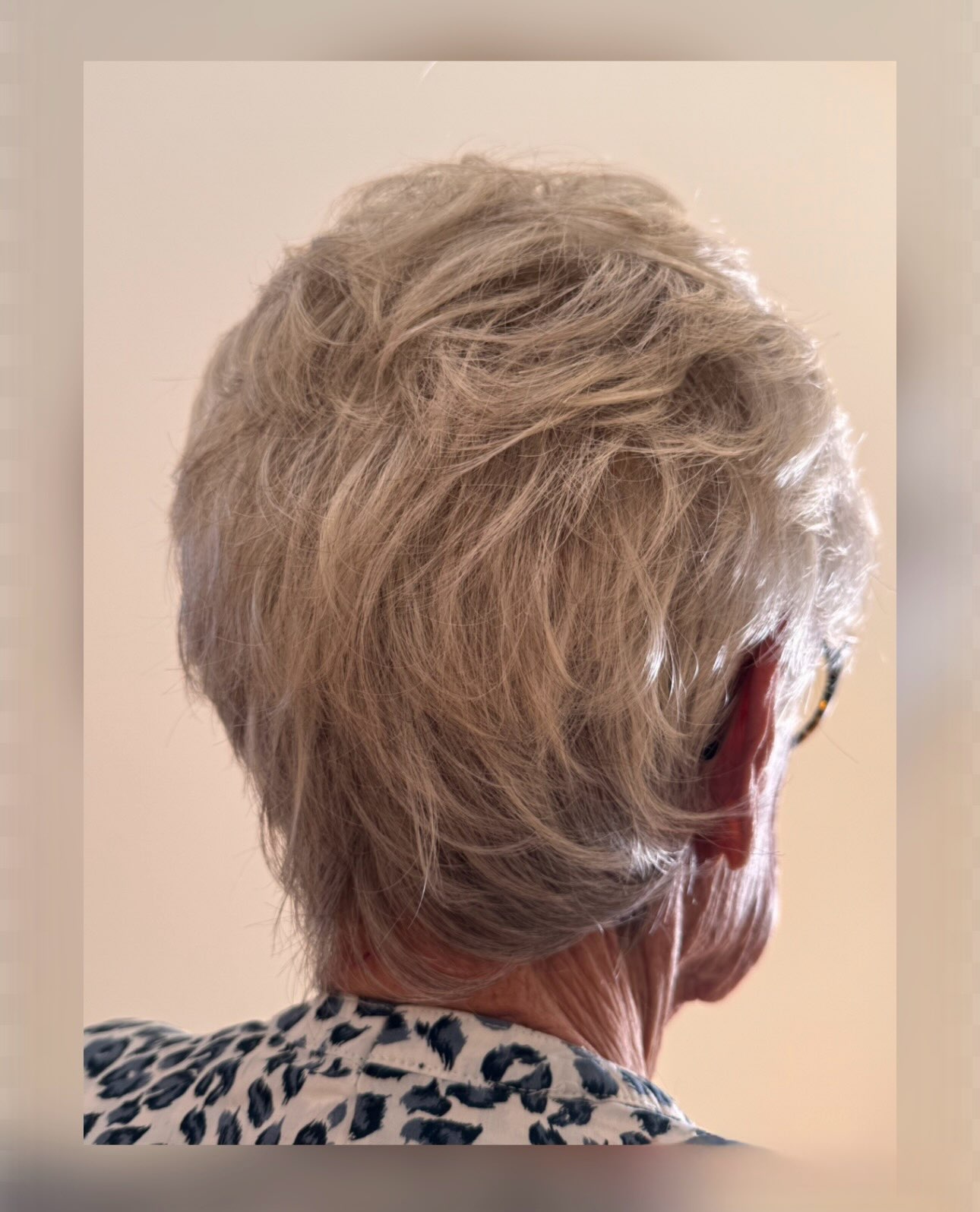 🎗️ Quand la Perruque devient un RETOUR À SOI ,
SA FÉMINITÉ MAGNIFIQUEMENT RETROUVÉE ,
Du confort en sur-mesure ….
#liguefribourgoiscontrelecancer #liguevaudoisecontrelecancer #perruquemedicale #perruquedequalité #perruquecheveuxnaturel