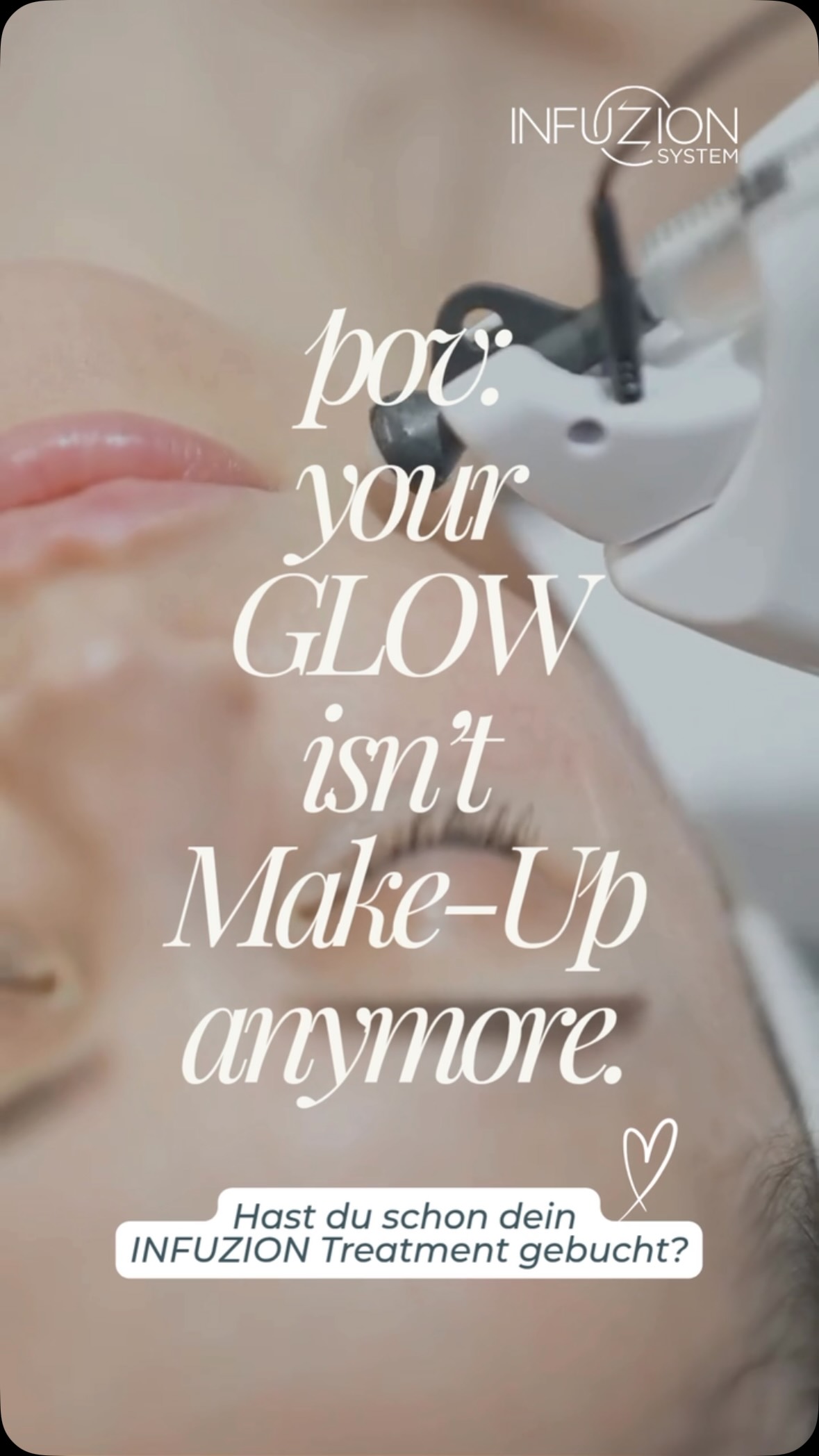 POV: Your GLOW isn’t Make-Up anymore. ✨
Es geht nicht darum, deine Haut zu überdecken.
SKIN QUALITY is the new Make-Up. ✨
INFUZION kombiniert ausgewählte, hochqualitative sterile Wirkstoffkomplexe aus hydrolysierter Lachs-DNA, pflanzlichen Exosomen, Hyaluronsäure, Glutathion u.v.m. mit einer innovativen und patentierten Behandlung – ohne Nadeln. Ohne Downtime.
Für intensive Hydration, einen frischen Glow und ein sichtbar verfeinertes Hautbild.
No need for Make-Up.
Just fresh-looking and glowing skin.
Natürlich. Sichtbar. DU.
Hast du dein INFUZION Treatment schon gebucht? ✨
#infuzion #naturalbeauty #glow