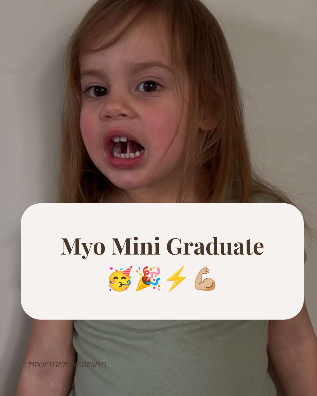This sweet client excelled in the Myo Mini Program 🤍🎈
This family had some health concerns, but when they noticed the symptoms I share aligned with Emilia’s poor sleep & breathing, they knew they wanted different for her.
Hesitant at first to know if Emilia would do the exercises, but they found them simple & easy!
And Emilia even started doing her favourites randomly for fun 🤩
During 17 short weeks, they noticed significant changes
➡️ nasal breathing more
➡️ deeper sleep
➡️ less dark circles under eyes
➡️ lips closed overnight
➡️ mood improvement
& some other really amazing health changes when her sleep finally aligned.
What if this is the shift that stops the trajectory of a lifetime of airway issues? 🥹
Comment MINI to join us, and get the same mind-blowing results for your little one - and have some fun while doing it 🎉🎈👅