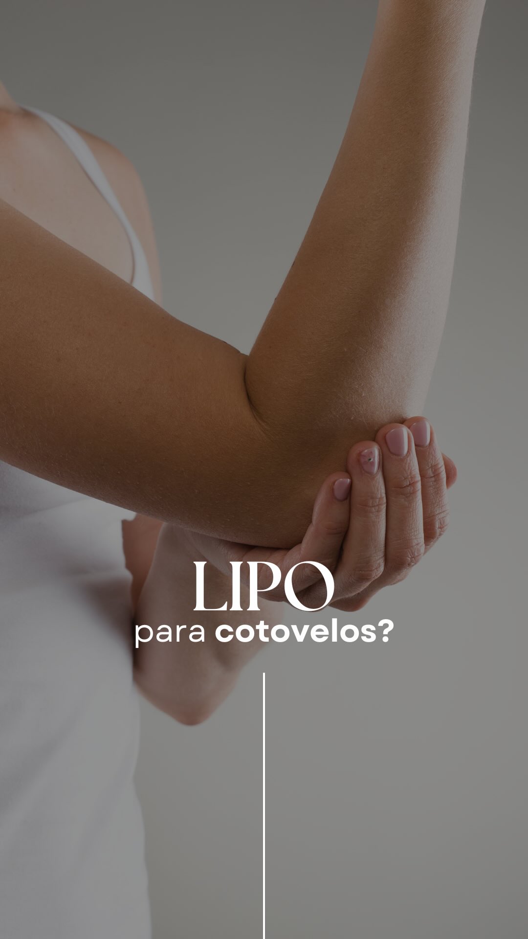 O cotovelo é uma região que exige bastante cuidado quando existe excesso de pele no braço.
Isso porque, ao tratar essa área, não basta pensar apenas em retirar o excesso. É preciso preservar uma quantidade adequada de pele para que o movimento do braço não seja comprometido.
Por isso, uma retirada excessiva pode trazer um problema que vai muito além da estética.
O planejamento precisa considerar a quantidade de pele, a flacidez, a distribuição da gordura e, principalmente, a mobilidade da região.
Em cirurgia de contorno corporal, nem sempre retirar mais significa tratar melhor.
Cada detalhe precisa ser pensado para buscar um bom resultado sem comprometer a função.
Dr. Guilherme Ferretti | CRM 5288161-9
Agende uma consulta📲 (21) 99881-1411 ou link na bio
#drguilhermeferretti #cirurgiaplastica #liporj #plasticarj