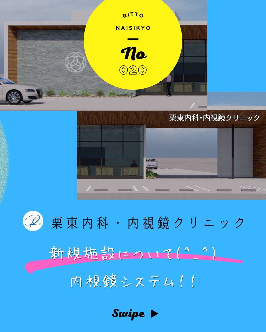 こんにちは!!
栗東内科内視鏡クリニックです。
2026年12月1日にリニューアルオープン予定の新施設の紹介です。
新施設では、内視鏡診療体制をさらに充実させます。富士フイルムメディカル社より、2026年6月に発売された最新型800シリーズより、上部消化管用拡大スコープ「EG-860Z」、下部消化管用拡大スコープ「EC-860ZP」と、AI技術を活用した内視鏡画像診断支援システム「CAD EYE」を新規導入します。
新施設では内視鏡室を2室に増設し、最新の内視鏡機器とAI画像診断支援技術、そして2名の内視鏡専門医による診療体制を組み合わせることで、これまで以上に精度の高い検査と、より多くの患者さまに受けていただきやすい内視鏡診療体制を目指してまいります。
今後も、苦痛の少ない検査と質の高い内視鏡診療を提供できるよう努めてまいります。
#栗東内科
#新規移転
#12月1日オープン
#AI搭載内視鏡
#胃カメラ大腸カメラ