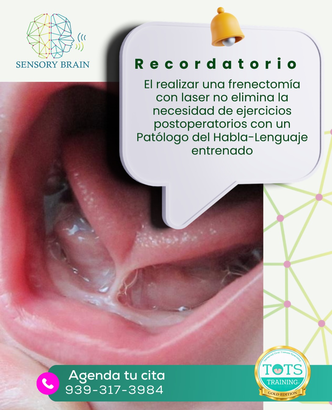 Los frenillos NO son moda, el PHL evalúa su funcionalidad para efectos de habla o alimentación.
¿Dudas o preguntas? Consulta con un profesional entrenado en el área
☎️ 939-317-3984