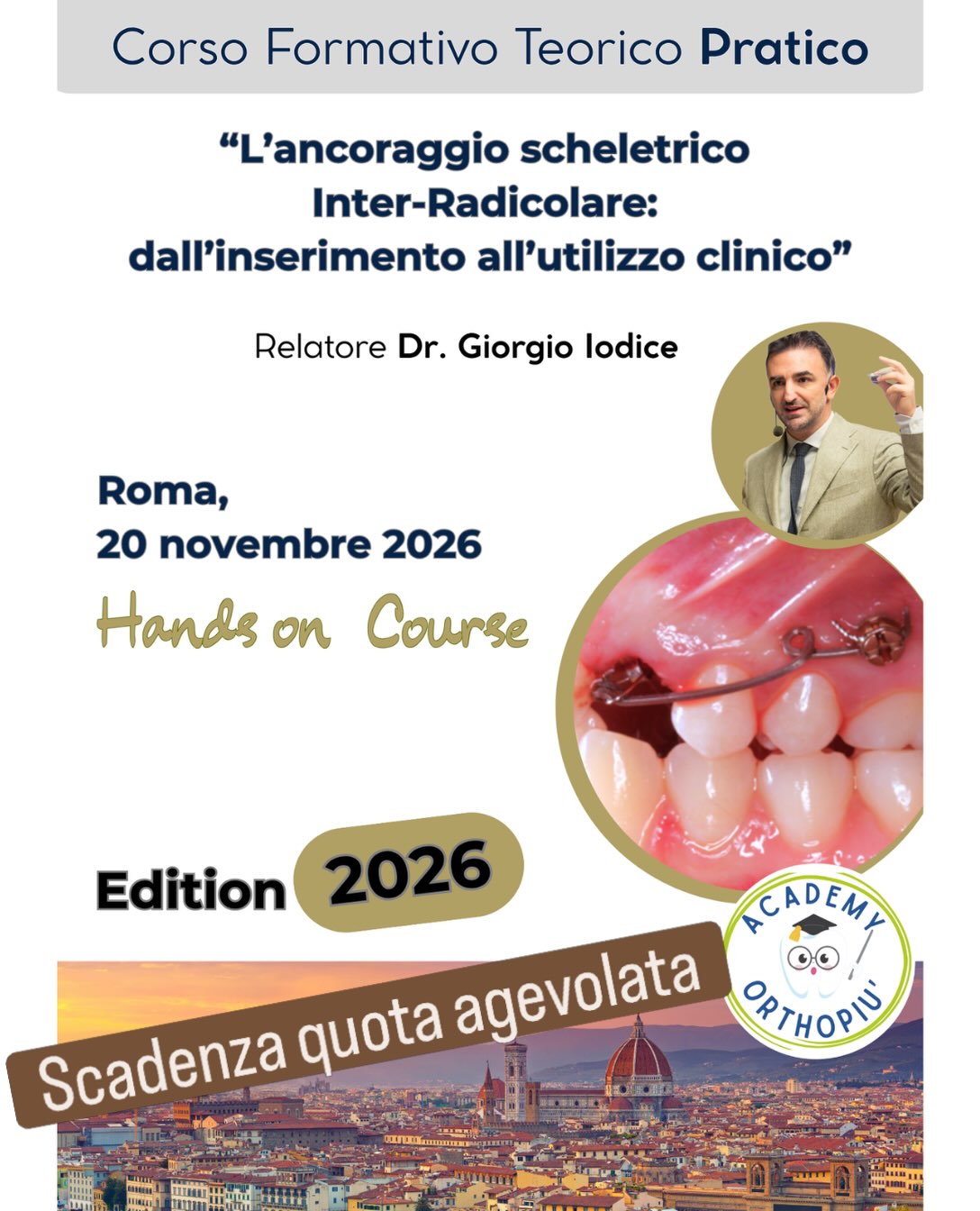 ULTIMI GIORNI PER LA QUOTA AGEVOLATA
Questo weekend scade la quota agevolata per iscriversi al nostro corso dedicato all’ancoraggio scheletrico.
📍 Roma
📅 20–21 novembre
Due giornate dedicate ad approfondire indicazioni, protocolli e applicazioni cliniche dell’ancoraggio scheletrico, con un approccio concreto e orientato alla pratica.
Se stai pensando di partecipare, questo è il momento giusto per completare l’iscrizione e approfittare della quota agevolata prima della scadenza.
👉 Iscriviti entro questo weekend.
#ancoraggioscheletrico #ortodonzia #FormazioneOdontoiatrica #corsoortodonzia #ortodontista