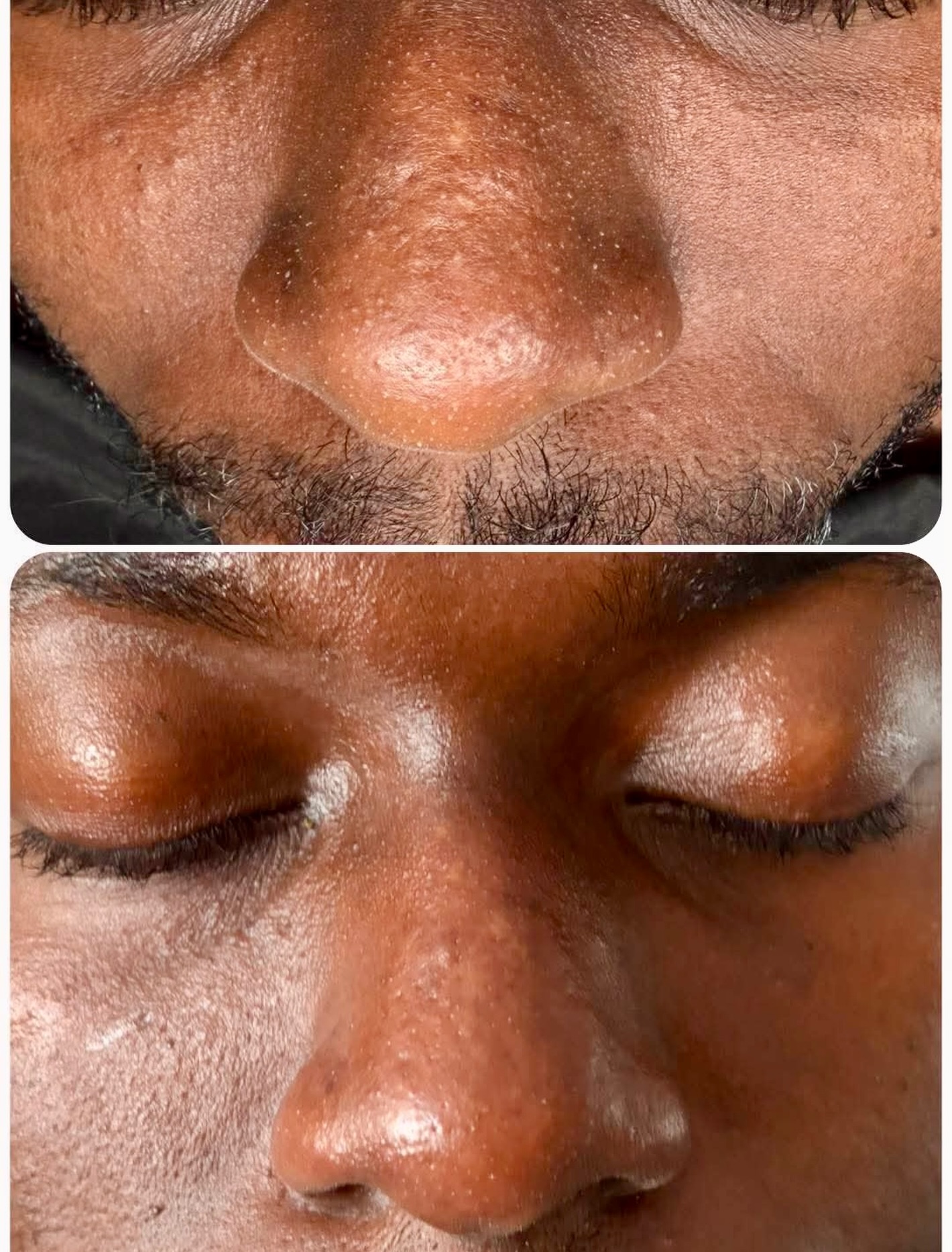 Congested pores? Breakouts? Buildup?
Our Clear Skin Facial is designed to deeply cleanse the skin and safely remove pore-clogging buildup through professional extractions…leaving your skin looking fresh, smooth & refreshed.
The difference is in the details. 🤌🏻