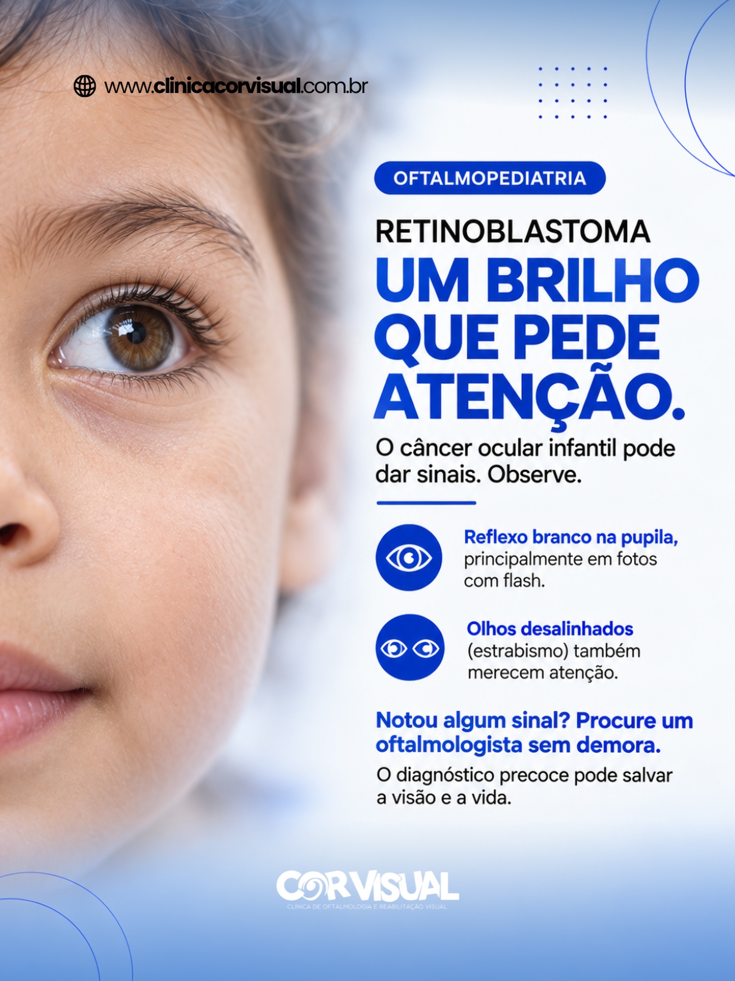Um brilho no olhar que merece atenção! 👁️⚠️
O retinoblastoma é um câncer que se desenvolve na retina e afeta principalmente crianças pequenas. O diagnóstico precoce pode salvar a visão e a vida! 💙
Um dos principais sinais de alerta é o reflexo branco na pupila, que pode aparecer em fotos com flash. Olhos desalinhados (estrabismo) também merecem atenção.
Para cuidar da saúde ocular do seu pequeno:
• Observe alterações no olhar e no alinhamento dos olhos.
• Fique atento ao reflexo branco na pupila, especialmente nas fotografias.
• Mantenha as avaliações oftalmológicas desde a infância.
• Ao perceber algum sinal, procure um oftalmologista sem demora.
Esses sinais podem ter outras causas, mas precisam ser investigados. Não espere sentir dor ou a criança reclamar para buscar orientação! 👍🏻
Cuidar do olhar desde cedo é um gesto de amor. Compartilhe este alerta com outras famílias! 💙
📍 Clínica Cor Visual
Rua Maciel Pinheiro, 360 — Empresarial Ramos
Salas 605 e 607 — Centro, Campina Grande - PB
📱 WhatsApp: (83) 99612-0813
☎️ Telefones: (83) 3322-3590 | (83) 3063-3590
Clínica Cor Visual – CNES 5.695.600
Responsável Técnica Médica Dra. Silvane Lara – CRM-PB 5.009, Oftalmologista – RQE 3744
#OftalmologistaCampinaGrande #Retinoblastoma #Oftalmopediatria #Oftalmologista #CampinaGrande
-
Marketing e Produção Audiovisual: @Kactus.Agencia 🌵