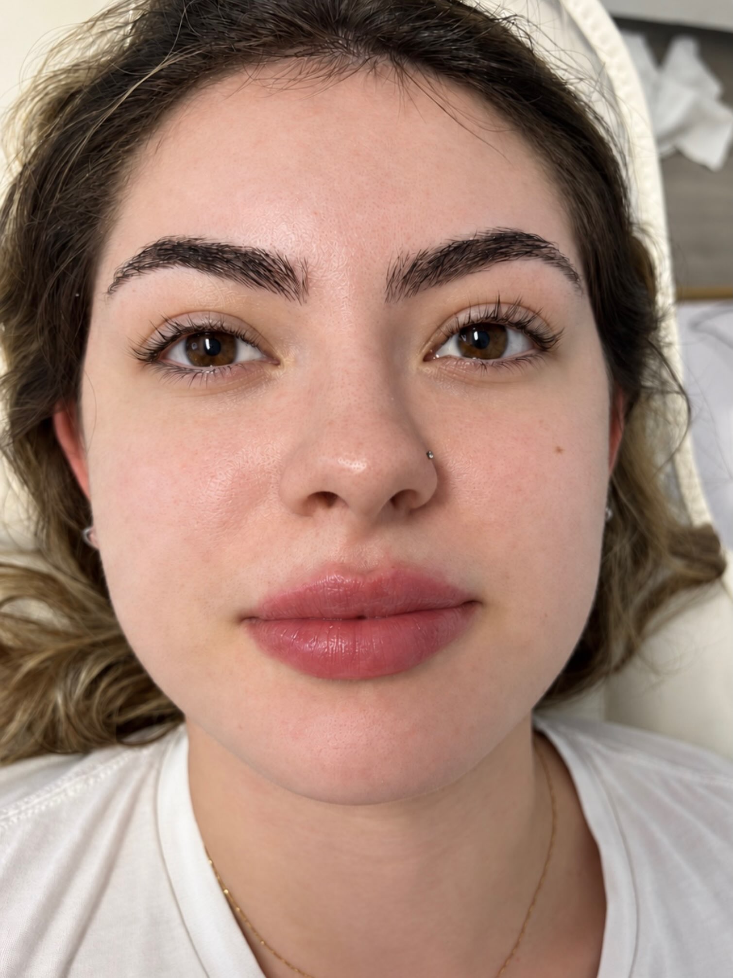 Fresh from today 😍💋 Soft, beautifully defined and perfectly balanced 👄✨
A subtle lip enhancement designed to add shape, hydration and natural-looking volume while complementing her features.
📍 Oxford & Swindon
📩 DM to book your consultation
#LipEnhancement #LipFillerResults #NaturalLips #AestheticsByAM #OxfordAesthetics SwindonAesthetics