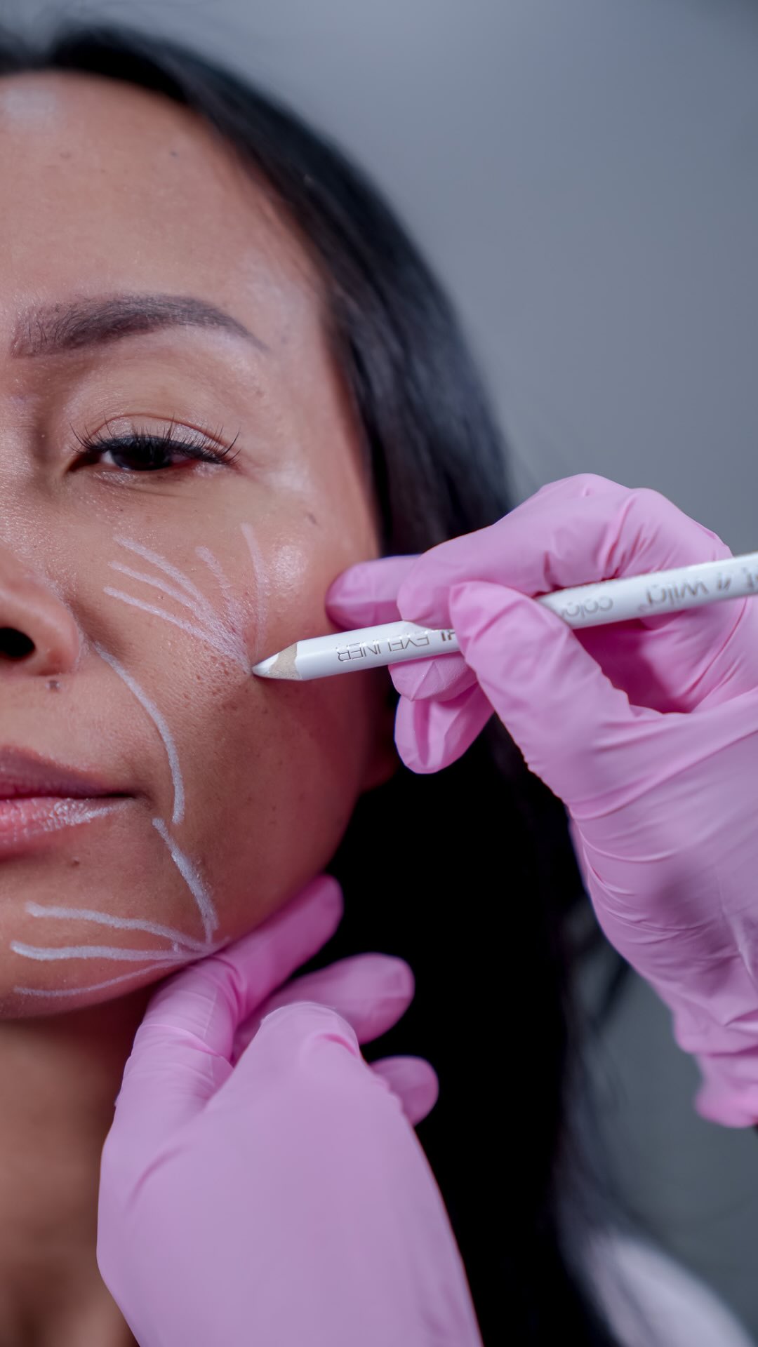 Facial balancing isn’t about making every feature bigger. It’s about understanding how every feature works TOGETHER. 💉
👩⚕️ One of the biggest misconceptions about facial balancing is that it means adding filler everywhere.
It doesn’t.
A thoughtful facial balancing consultation looks at your face as a whole, not as a collection of individual features that need to be “fixed.”
Your plan may evaluate the relationship between your:
✨ Cheeks
💋 Lips
🧬 Chin
✨ Jawline
👤 Profile
😊 Natural movement
Because here’s where it gets interesting:
The feature that’s bothering you isn’t necessarily where the treatment plan begins.
👩⚕️ Sometimes filler may be appropriate in multiple areas. Sometimes only subtle support is needed. And sometimes filler isn’t the right answer at all.
More isn’t the goal. Balance is.
Curious what facial balancing could look like for your anatomy? Start with a consultation at Rejuvé. 💉
#hawaiiaesthetic #medspahonolulu #hawaiimedspa #hawaiiesthetician