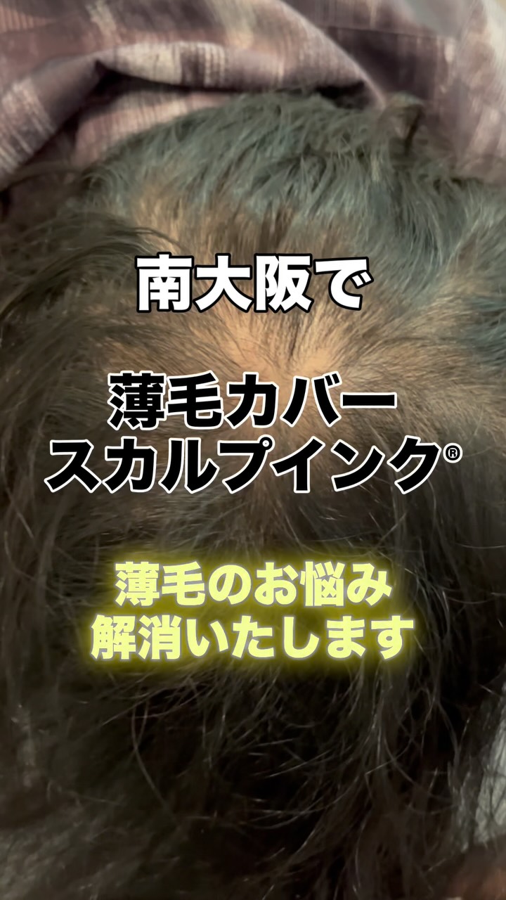 その薄毛、まずは“スカルプインク®“が自分に合うのか、から試しませんか?
当店では、皆様に安心して試していただけますように。初回施術で定着適性を見極め、万が一合わない場合は半額返金保証いたします。
無理に続けさせることはありません。結果に自信があるから、この仕組みです。
👉まずは“あなたに合うか”を確認してください。
【初回適正診断保証(半額返金)】
初回施術後、頭皮状態や色素の定着を確認し、当店基準で継続が難しいと判断した場合、初回施術費用の半額を返金いたします。
※以下の場合は対象外
・当店が継続可能と判断した場合
・お客様都合による中断など
・デザインの好みによる不満など
・アフターケア未実施など
──────────────────────
髪が薄くなると、見た目だけでなく気分まで沈みがち。
でも、もう一人で悩まなくて大丈夫です。
前髪・つむじ・分け目。
どこから見られても怖くない自然な仕上がりへ。
スカルプインク®は極小ドットで濃さを再現する
“最もバレにくい”頭皮タトゥー技術。
・痛みほぼなし/麻酔不要
・色落ちしにくい専用インク
・即日変化を実感/男女対応
産後脱毛・円形脱毛・傷跡にも対応。
──────────────────────
※美容師歴20数年の認定アーティストが責任を持って施術します。
※この地で開業18年となります、ご安心してお任せください。
大阪・和泉市|THREE BRANCHES
✨今なら3.3万発
49500円が33,000円(税込)
今なら何度でも‼️
📩公式LINEでご相談ください。
#スカルプインク
#薄毛対策
#SMP大阪
#スカルプインク大阪
#頭皮タトゥー大阪
※大阪で薄毛で悩まれている男性も女性も
ぜひ1度お声掛けください。