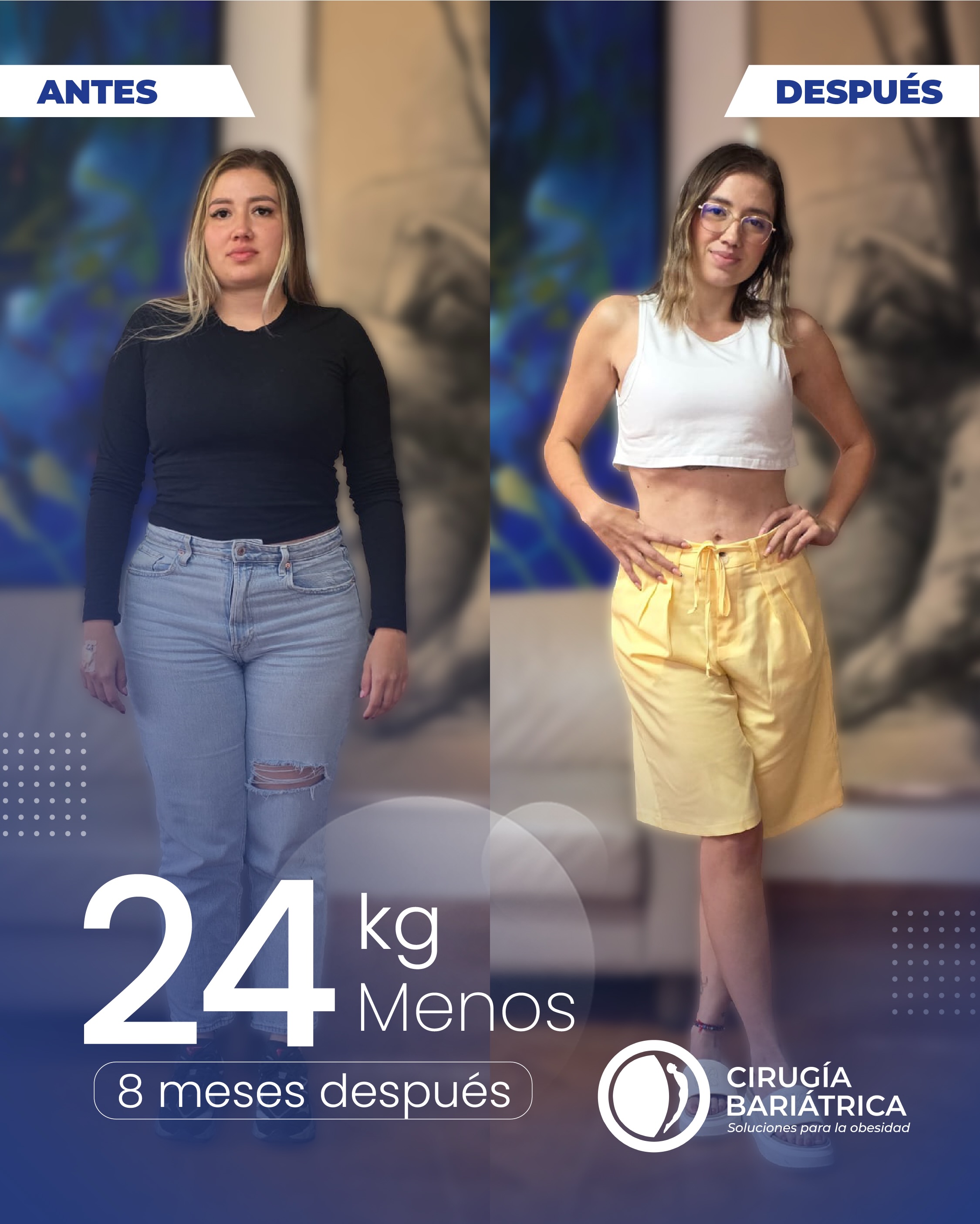 Resultados que hablan por sí solos: 24 kilos menos en solo 8 meses.👏✨
La cirugía bariátrica del Dr. Bolaños y su equipo está diseñada para lograr excelentes resultados y mejorar la calidad de vida de cada paciente, con tecnología, experiencia y compromiso.🌻
Contactos: +57 3155659167 | +57 3152887610 | Inglés o español ✅
#CirugíaBariátrica #Transformación #beauty