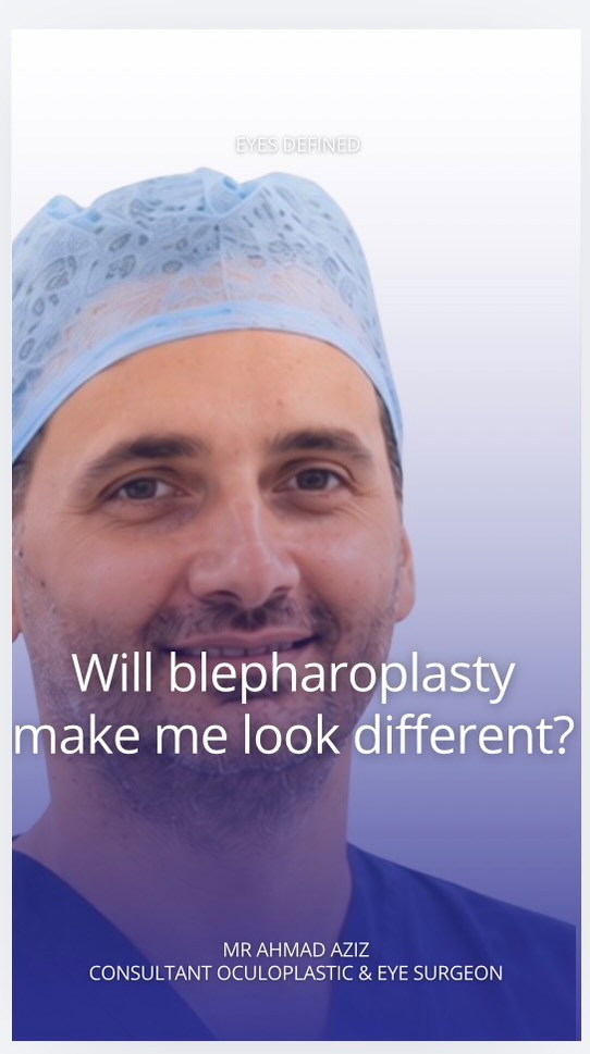 Will blepharoplasty make me look different?
A common concern — and an important one. The aim shouldn't be to change someone's face, but to understand their individual anatomy and achieve a result that still looks like them.
#Blepharoplasty #EyelidSurgery #Oculoplastics #London
