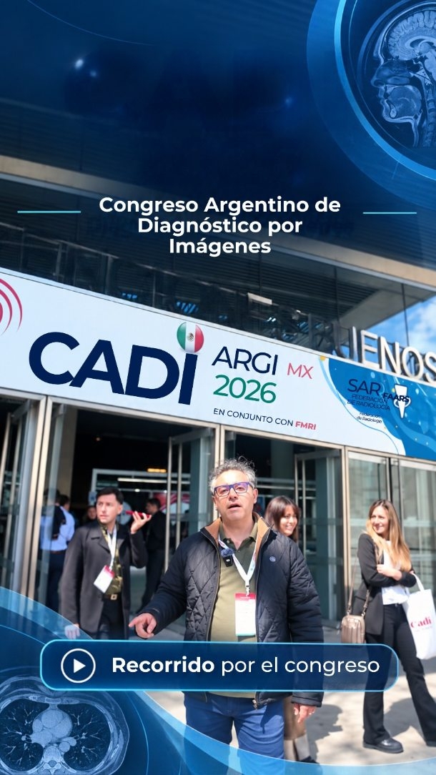 Un recorrido por **CADI 2026** 🩻✨
Tecnología, innovación, nuevas herramientas y mucho aprendizaje en uno de los encuentros más importantes del **Diagnóstico por Imágenes**.
Siempre es bueno salir de la rutina, recorrer, actualizarse y conocer qué se viene en nuestra especialidad. Muchas de estas novedades después terminan transformándose en mejores estudios, mejores diagnósticos y una mejor atención para nuestros pacientes.
Seguimos aprendiendo y buscando nuevas ideas para llevar a **Centro Diagnóstico Mendoza**.
📍 CADI 2026
Congreso Argentino de Diagnóstico por Imágenes
#CADI2026 #DiagnosticoPorImagenes #Radiologia #Ecografia #ImagenesMedicas #TecnologiaMedica #InnovacionMedica #ActualizacionMedica #CentroDiagnosticoMendoza #CDM