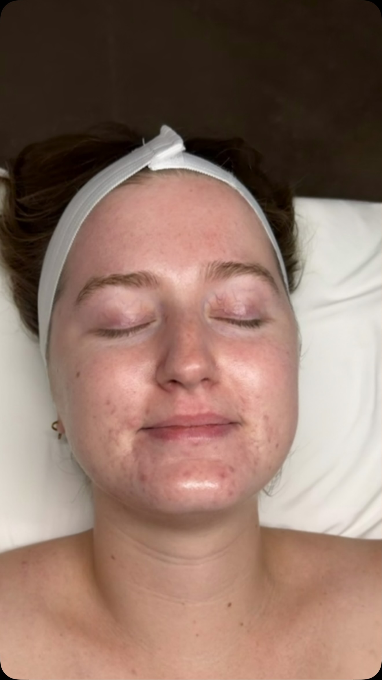 Yes, it’s true, our Acne Bootcamp is in full force, and we’re ready to help. ✨
If you’ve been waiting for a sign to finally tackle your acne, this is it.
Our Acne Bootcamp is designed for those who are tired of trying product after product with little to no results. Through a customized treatment plan, professional skincare recommendations, and expert guidance, we’ll help you create a clear path toward healthier skin.
No guessing. No trends. No one-size-fits-all solutions.
Just a personalized approach designed to help you achieve the complexion you’ve been working toward.
#medspa #onyxmedspanea #acnetreatment