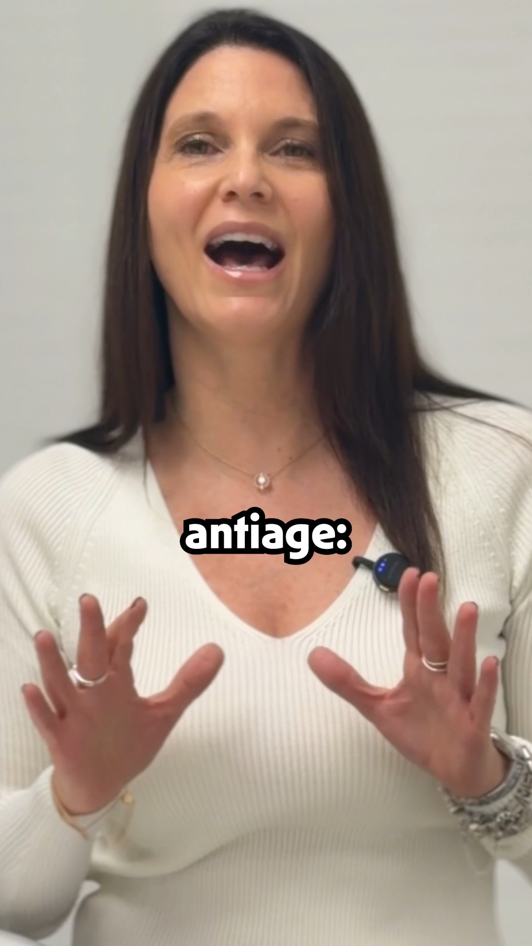 ✨ ¿Isotretinoína como ANTIAGE? Sí, pero no es para todo el mundo.
Cuando hablamos de isotretinoína, inmediatamente pensamos en acné. Sin embargo, este retinoide también ha sido estudiado en dosis bajas y pacientes seleccionados por sus posibles efectos sobre el fotoenvejecimiento.
¿Qué podemos buscar con este tipo de tratamiento?
✨ Mejorar la textura de la piel
✨ Disminuir la oleosidad
✨ Mejorar la apariencia de los poros
✨ Atenuar líneas finas
✨ Favorecer una piel más uniforme y luminosa
✨ Actuar sobre algunos de los cambios asociados al daño solar acumulado
Pero atención 👇
💊 No se trata de tomar isotretinoína simplemente para “rejuvenecer”.
Su utilización con objetivos de fotoenvejecimiento debe evaluarse individualmente según la edad, tipo de piel, antecedentes, medicación, exposición solar y objetivos de cada paciente.
⚠️ Requiere indicación y seguimiento dermatológico y tiene contraindicaciones importantes. En mujeres con posibilidad de embarazo, la prevención del embarazo es indispensable debido a su elevada teratogenicidad.
☀️ Y ningún tratamiento reemplaza lo fundamental: fotoprotección FPS 50+ todos los días.
👉 ¿Tenés piel grasa, poros visibles, acné adulto y signos de fotoenvejecimiento?
Tal vez podamos diseñar una estrategia que trate varios de estos problemas al mismo tiempo.
📲 Solicitá tu consulta dermatológica.
📍 Doctora Buonsante Dermatología y Estética – CABA
👩⚕️ Dra. María Eugenia Buonsante
📲 Turnos y consultas por mensaje directo
Instagram: @drabuonsante
#Isotretinoina #AntiAge #Fotoenvejecimiento #SkinAging #Dermatologia #PielGrasa #Poros #RejuvenecimientoFacial #SkinLongevity #Dermatologa