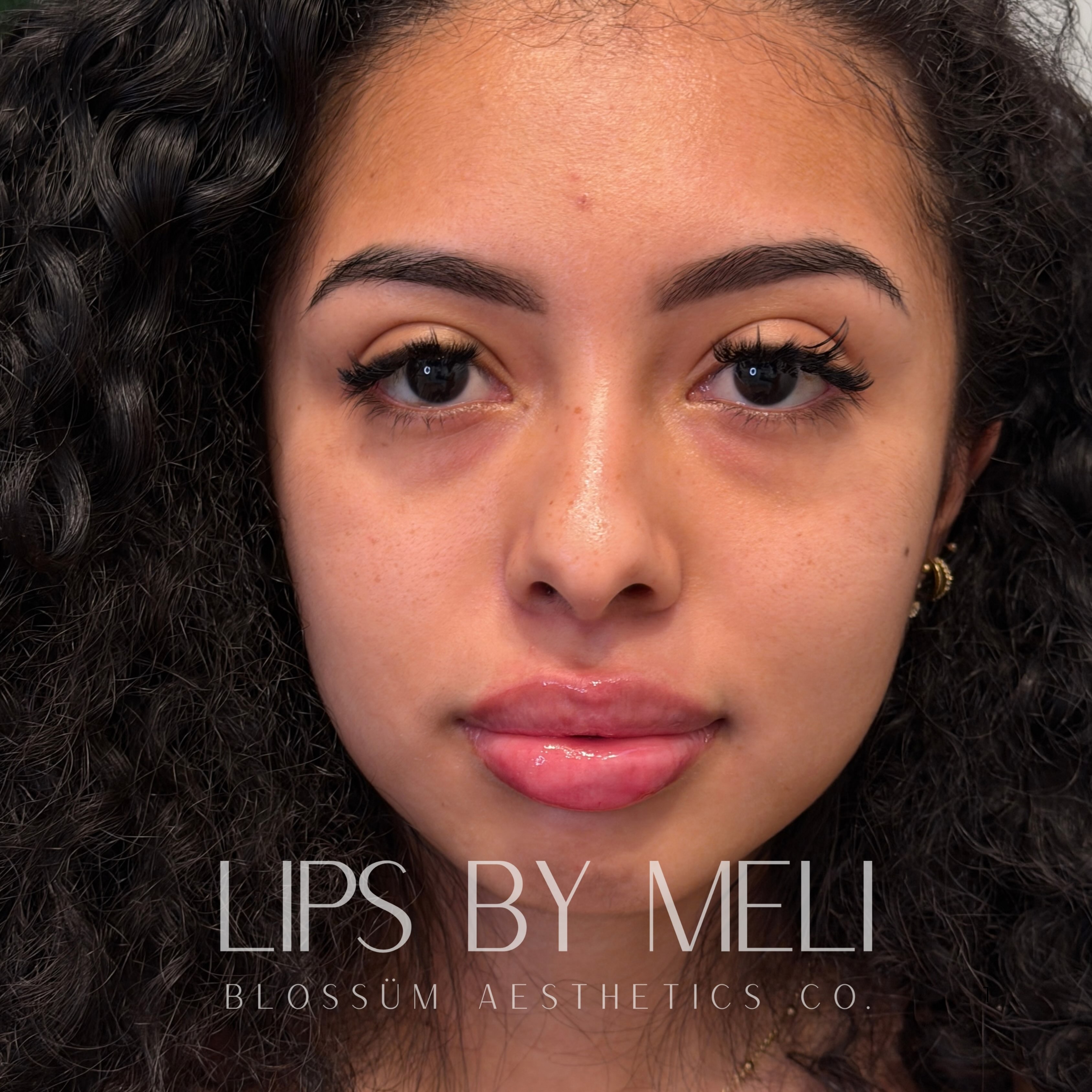 Just a beautiful set of lips 👄
#lipsbymeli #lipfillerraleigh