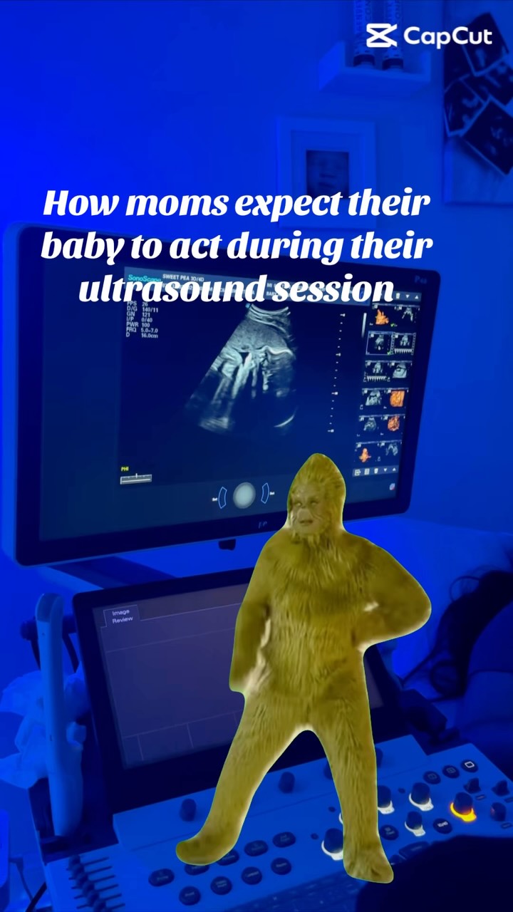 We love capturing the real, unscripted moments just as much as the picture-perfect ones 💚
Ready to see what your little one is up to?
#PregnancyHumor #ultrasoundstudio