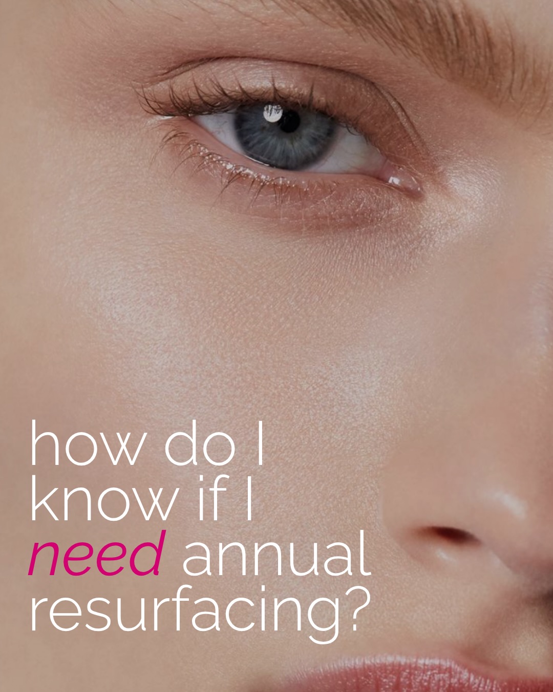 How do you know when it’s time for laser resurfacing?
Maybe the pigmentation you cleared last year is starting to creep back. Your skin feels a little rougher, pores are looking more noticeable, or fine lines are sticking around longer than they used to. Maybe you’re not trying to “fix” anything at all, you simply want to maintain the skin you’ve worked hard to improve.
Resurfacing isn’t about waiting until your skin gets “bad enough.” For many patients, it becomes part of their annual maintenance because it can address pigment, texture, pores, fine lines, acne scarring and overall skin quality while also stimulating collagen.
And at Skin Worthy, our go-to resurfacing treatment is The Glow Getter a treatment stack of BBL + HALO that almost every member of our team incorporates into their own skin plan.
For patients who need more intensive correction, we can go deeper. TRL resurfacing is designed for more advanced lines, wrinkles and texture, and during our Laser Event we’re offering 20% savings on TRL Eye or Lower Face packages.
For everyone else, there are three ways to Glow this Fall:
Glow Getter | $1,685 — save $370
BBL + HALO + custom ZO® post-procedure kit + topical VAMP™ Advanced.
Glow Getter Tight | $2,185 — save $1,170
Glow Getter + lower-face Morpheus8 + post-procedure kit + VAMP + complimentary hand add-on.
Glow Getter Plus | $2,880 — save $1,270
Glow Getter for the face, neck + décolletage + post-procedure kit + VAMP + complimentary hand add-on.
There are still spots available for The Laser Event on October 6, 6:30–8:30 PM.
RSVP to 647-350-7546 - you and your skin do not want to miss this!