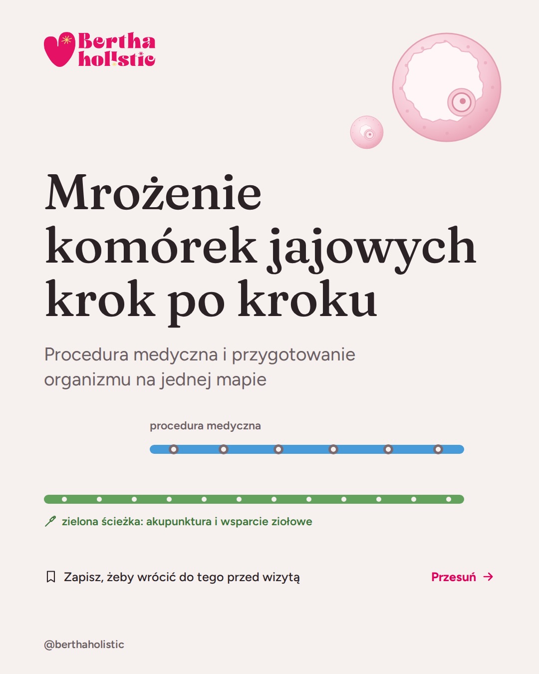 🥚 Mrożenie komórek jajowych nie zaczyna się w dniu pierwszego zastrzyku.
Zanim dojdzie do punkcji, czeka Cię kilka etapów: kwalifikacja, badania, ustalenie protokołu, stymulacja, kontrole USG, zastrzyk wyzwalający i sama punkcja.
Rozrysowałam je jak mapę, żebyś wiedziała, co Cię czeka i w których momentach pojawiają się zastrzyki. 🌸
Na mapie jest też druga, zielona linia. To ścieżka przygotowania i wsparcia organizmu, która może zacząć się nawet około 3 miesięcy przed procedurą. Mniej więcej tyle dojrzewa w pęcherzyku komórka jajowa, która zostanie pobrana podczas punkcji.
Na tej ścieżce towarzyszę pacjentkom akupunkturą i wsparciem ziołowym:
🌱 przed procedurą – akupunktura raz w tygodniu i wsparcie ziołowe,
🌱 w trakcie stymulacji – akupunktura dwa razy w tygodniu i wsparcie ziołowe,
🌱 po punkcji – akupunktura raz w tygodniu, w czasie regeneracji.
Warto też zatrzymać się przy slajdzie o trzech liczbach.
Pęcherzyki widoczne na USG, pobrane komórki i dojrzałe komórki jajowe to nie to samo. Nie z każdego pęcherzyka udaje się pobrać komórkę i nie każda pobrana komórka jest dojrzała. To dojrzałe komórki są przeznaczone do witryfikacji.
Każda droga wygląda trochę inaczej. Protokół, leki, dawki i liczba kontroli są zawsze ustalane indywidualnie przez lekarza prowadzącego.
📋 Szczegółową listę badań przed procedurą znajdziesz w osobnej karuzeli na moim profilu.
📌 Zapisz tę karuzelę, żeby móc wrócić do niej przed wizytą.
Planujesz mrożenie komórek jajowych i chcesz dodatkowo przygotować organizm?
Umów konsultację, klikając „Zarezerwuj” w bio, albo napisz w komentarzu AKU. 🌿
Zaopiekuj się sobą w Bertha Holistic.
#mrożeniekomórekjajowych #zabezpieczeniepłodności #akupunktura #ziołolecznictwo #płodność