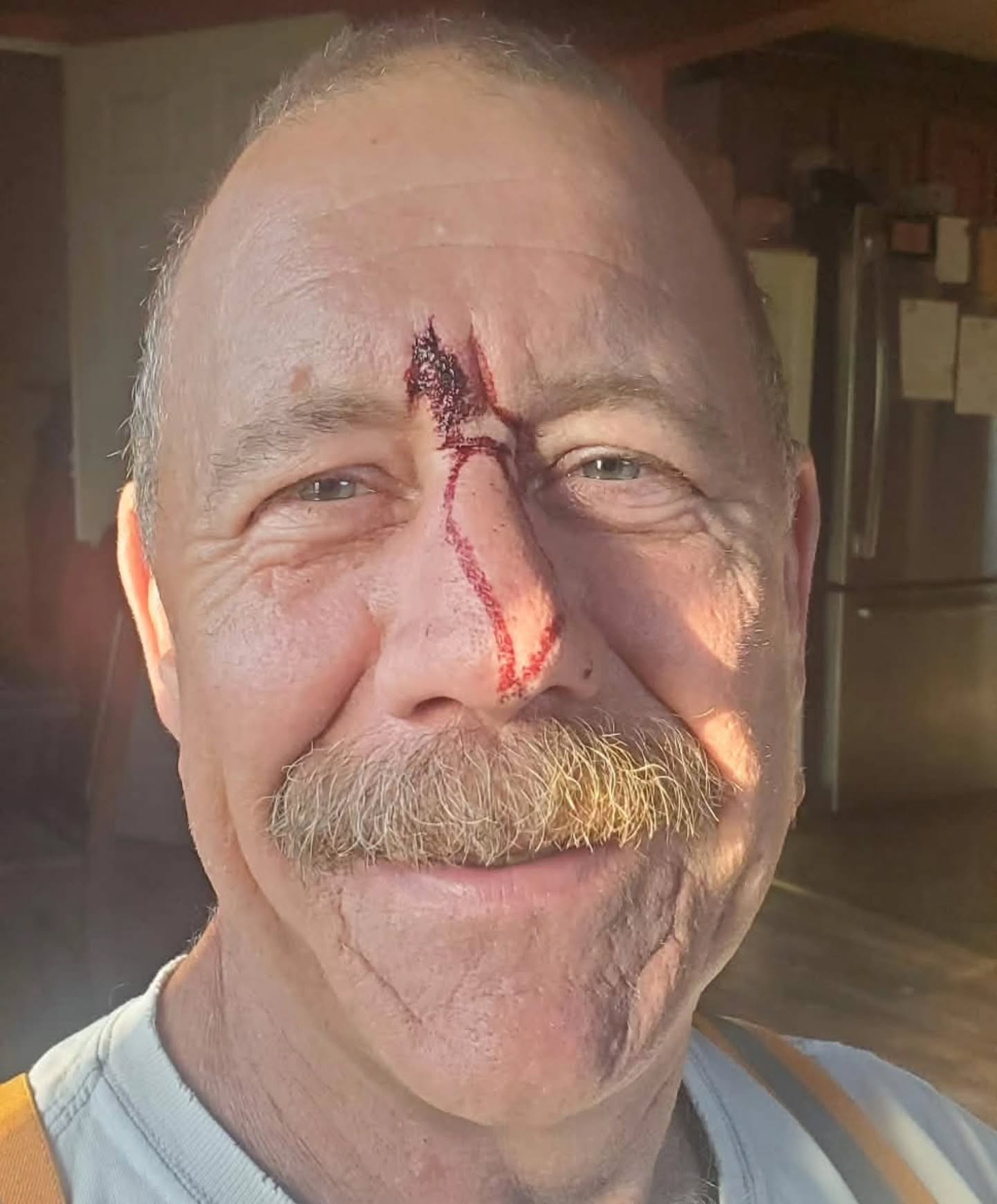 Sometimes, you need a little reminder!
#scopekiss #hunting #firstaid #reminder #sometimes