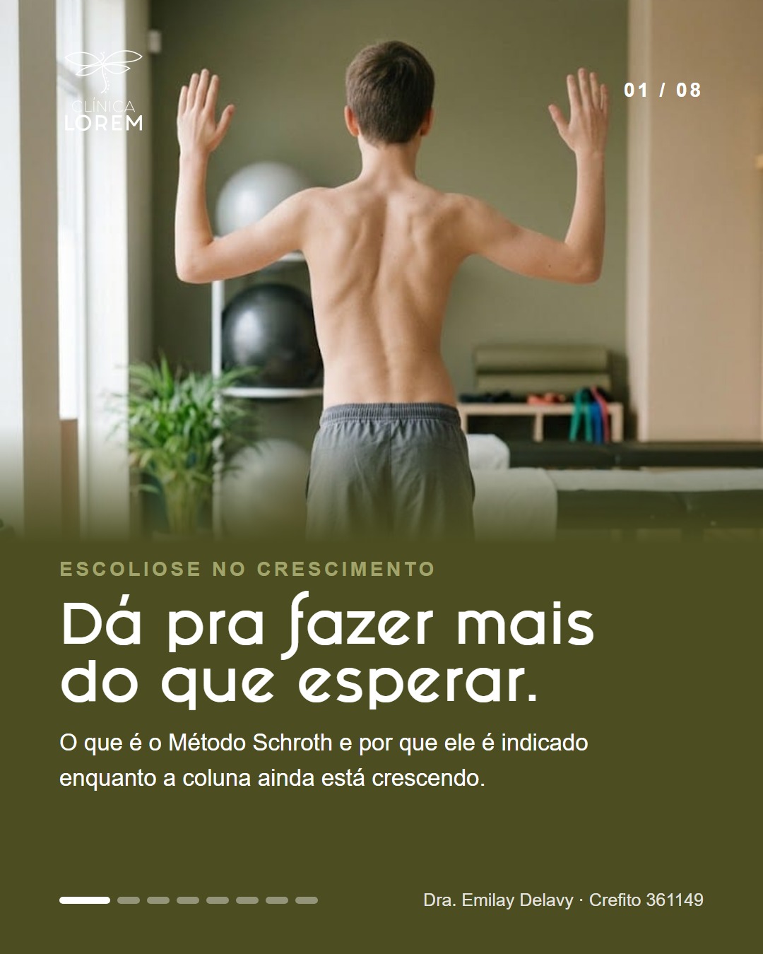 Dá pra fazer mais do que esperar.
O Método Schroth é uma fisioterapia específica para escoliose: cada exercício é montado para o padrão de curva de quem está fazendo.
Na adolescência, a escoliose tende a progredir nas fases de crescimento rápido, por isso o tratamento começa assim que ela é identificada. A diretriz internacional da SOSORT recomenda os exercícios específicos para escoliose como primeiro passo do tratamento.
Tudo começa pela avaliação: raio X e medida da curva, fotos posturais, fase de crescimento e um plano de exercícios explicado para a família.
Quanto antes avaliar, mais opções de cuidado. Agende pelo link na bio ou pelo WhatsApp (47) 99193-1511.
📍 Clínica Lorem — Itajaí
Dra. Emilay Delavy · Método Schroth · @emidfisio
#escoliose #metodoschroth #fisioterapia #coluna #clinicalorem #itajai