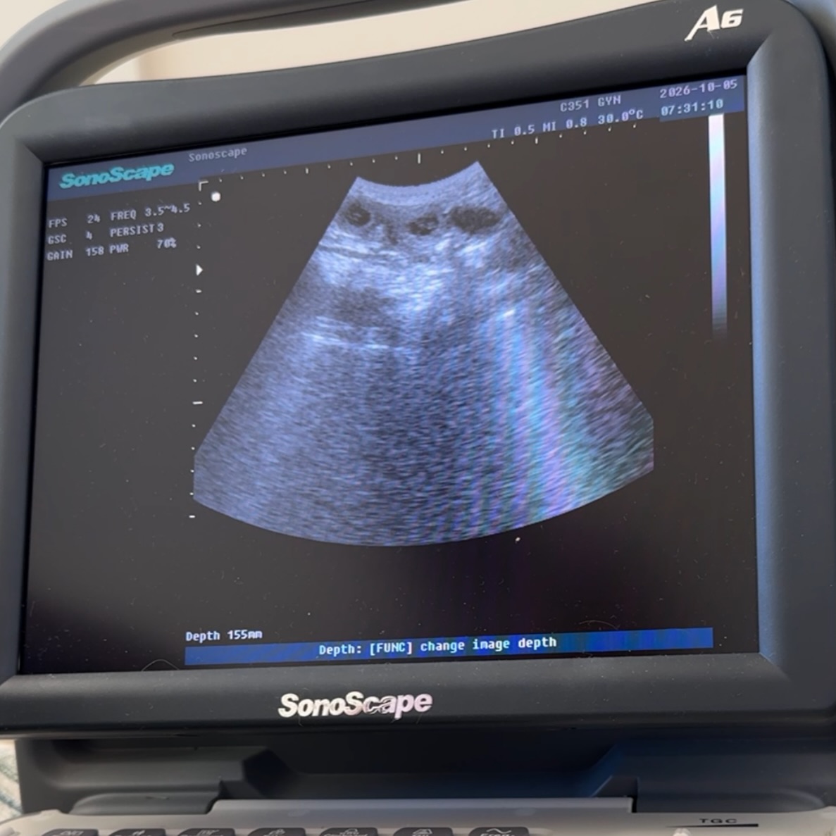 Tiny little heartbeats, coming soon. 🥹💕 Excited would be an understatement!
Our sweet Pocket Bernedoodles are officially on the way, and this waitlist is already fully reserved. We cannot wait to meet these babies! 🐾✨