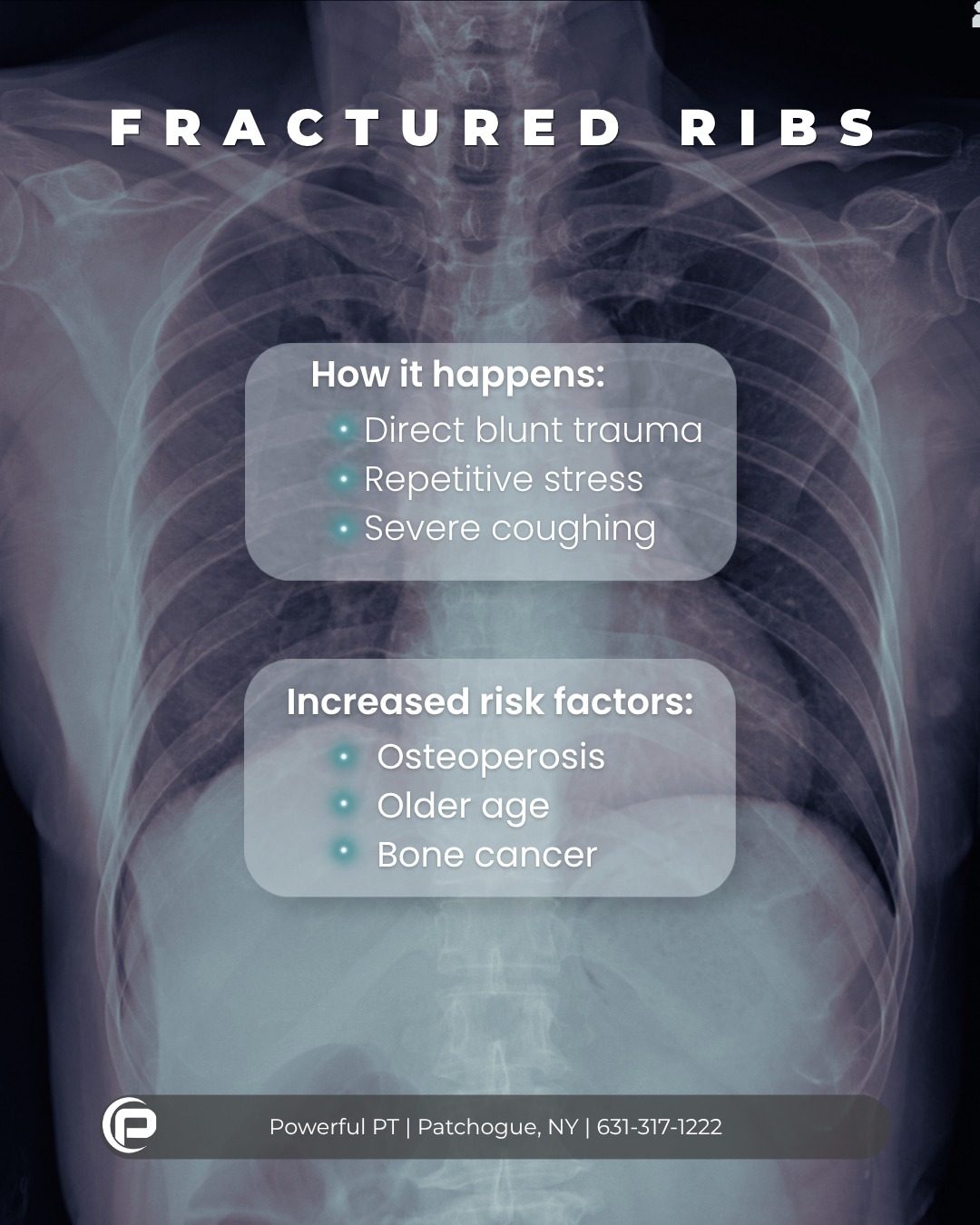 Fractured ribs are a tricky and painful injury. Learn more about them on this month's blog!
📍 www.powerfulpt.com
📞 631-317-1222
📧 info@powerfulpt.com
#fracturedribs
#physicaltherapy
#powerfulpt