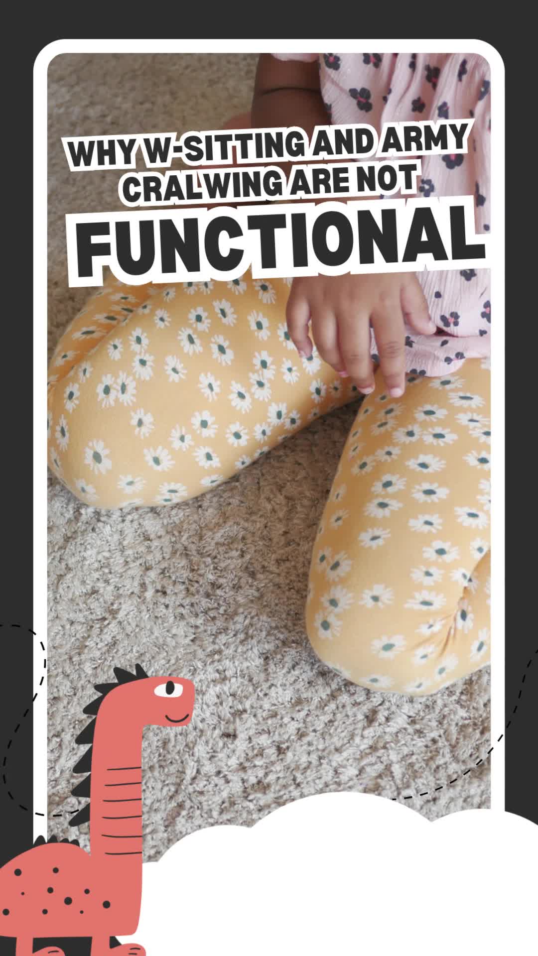 That cute w-sit? It's actually telling us something about core stability and midline crossing. 👀
ㅤ
As babies grow, they naturally move through developmental patterns — rolling, cross-crawling, pulling to stand — that require the left and right sides of the brain and body to communicate across the midline.
ㅤ
When a child consistently w-sits instead of sitting cross-legged, or army crawls (dragging the body forward) instead of true cross-crawling (opposite arm and leg moving together), it's often a sign that this cross-body communication isn't yet as efficient as it could be. Both patterns tend to show up when the core and hips are compensating for less-than-ideal stability, letting the body take the "easier" path instead of building the strength and coordination true cross-lateral movement requires.
ㅤ
Why does this matter? Cross-crawl patterns are how the brain builds those early left-right communication pathways — the same pathways later involved in things like coordination, reading, and focus.
ㅤ
Catching and supporting these patterns early gives a developing nervous system the best foundation to build functional movement on.
ㅤ
If you are noticing your child w-sitting, army crawling, or any other development pattern you don't feel is correct, we would love to show you how chiropractic can support your child through all phases of growth and development.