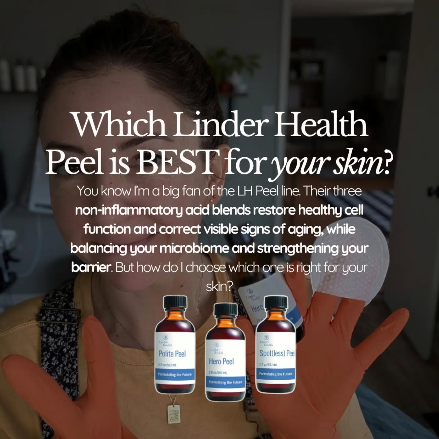 Not all chemical peels are built the same and your skin isn't one-size-fits-all, either.
That’s exactly why I rely on the Linder Health peel lineup. Instead of triggering intense, aggressive inflammation, these advanced formulas use selective cellular apoptosis, a process that targets and sheds damaged, obsolete cells while leaving healthy skin intact. The goal isn't to force your skin through days of painful recovery… it's to restore optimal function with minimal downtime.
🌿 Hero Peel | The All-Rounder
Designed for overall rejuvenation, dullness, fine lines, and uneven tone. Perfect when your main goal is simply fresh, radiant, healthier-looking skin.
🍄Spot(less) Peel | The Clarity Fix
Formulated for active breakouts, congestion, and excess oil. Powered by glycolic and salicylic acids to deep-clean pores, balance sebum, and fade stubborn post-acne marks.
🌼 Polite Peel | The Gentle Solution
Crafted for sensitive, reactive, or rosacea-prone skin with a delicate barrier. Delivers visible renewal without compromising comfort or causing harsh reactions.
The takeaway? The best peel isn't the most aggressive, it's the one tailored to your skin's unique needs.
Unsure which option fits your goals? Drop me a DM and let's customize a treatment plan designed for your skin.
📍 Santa Cruz, Ca| Book via link in bio