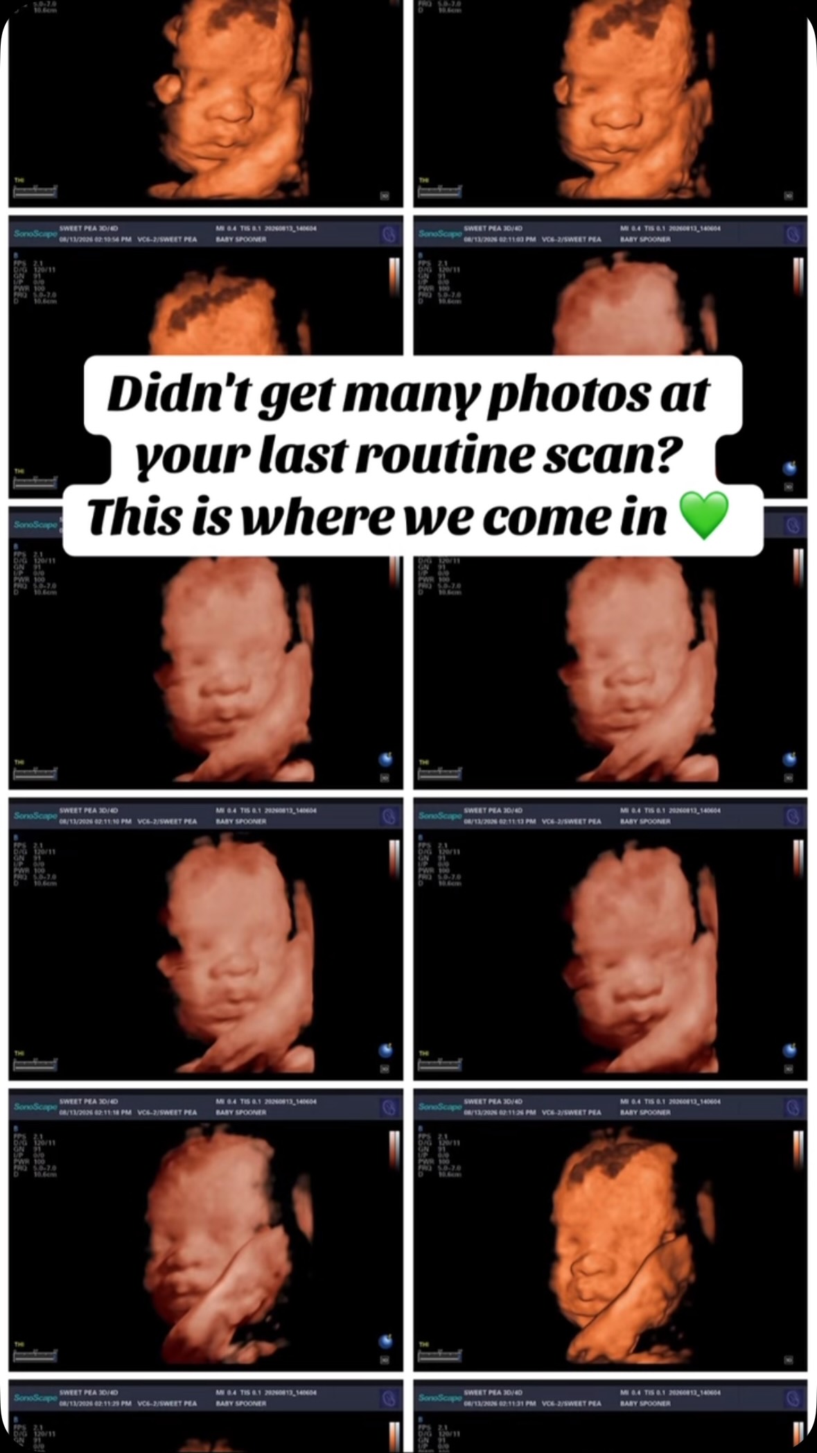 Because one photo is never enough!
At Sweet Pea, we love giving families the opportunity to slow down, connect, and capture those precious moments before baby arrives.
Book your Sweet Pea session today!
#electiveultrasound #sweetpea3d4d #babyphotos