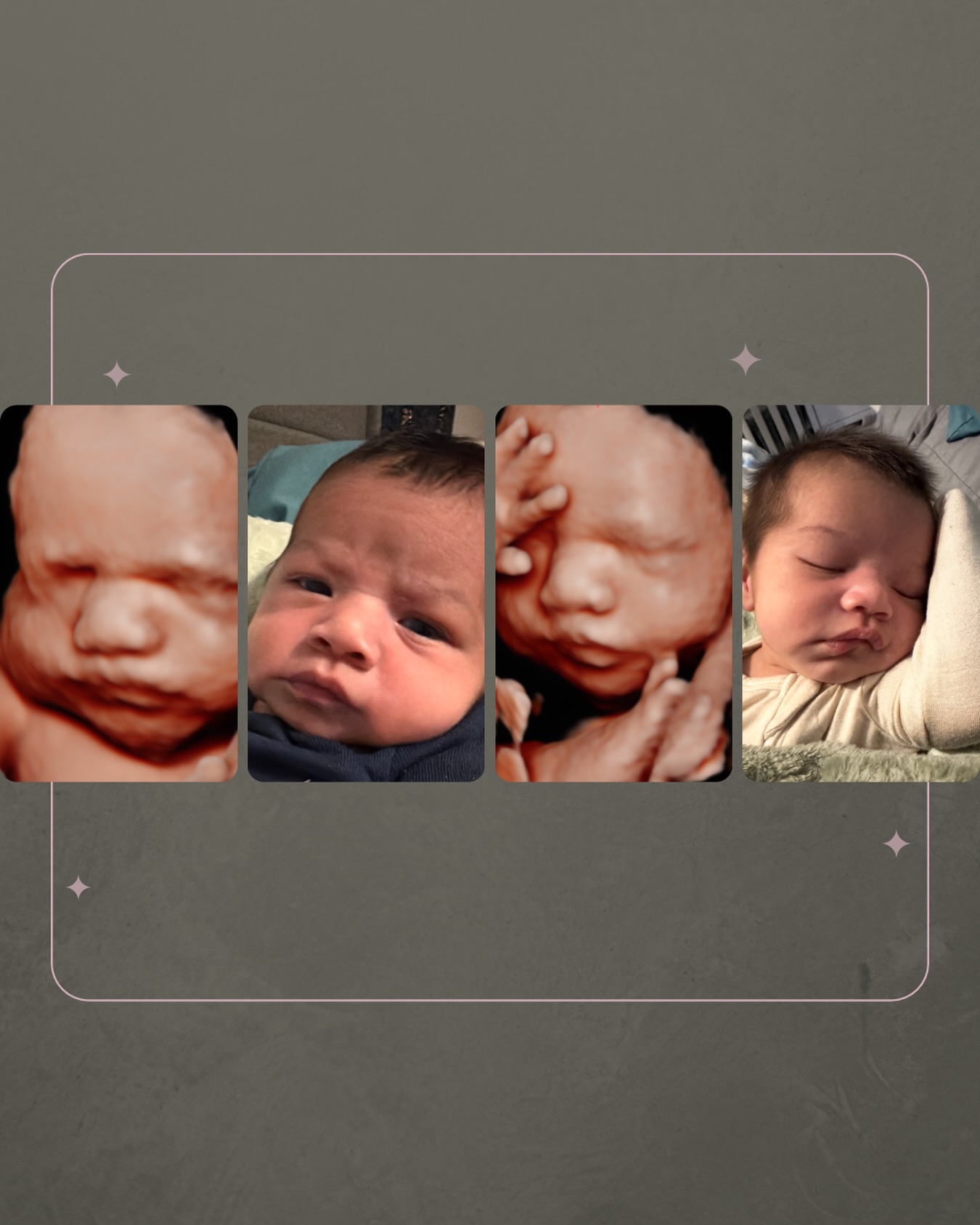 Are you kidding me?! 🥹 Look at that little face!! I swear these ultrasound vs. newborn comparisons are my favorite! This technology seriously leaves me speechless sometimes; the resemblance is perfection 😍
Welcome to the world Kylian Thiago! 🩵
-
-
-
-
-
📍 Precious Peek 5D Ultrasound | Vero Beach, FL
🤍 Serving Vero Beach, Port St. Lucie, Fort Pierce, Stuart, Sebastian & the Treasure Coast
✨ Elective 3D/4D/5D Ultrasound • HD/RealisticVue • Gender Reveals • 8K Images
📲 Book online at PreciousPeek5D.com
Se habla español 🤍