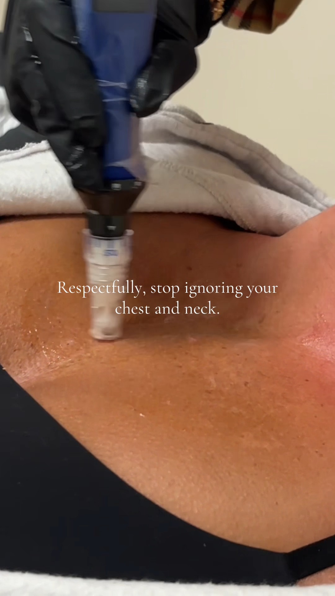 Your face has been getting all the attention. 👀
Consider this your reminder that the neck + chest deserve microneedling too. Collagen support, smoother-looking texture + a little extra love for two areas we tend to forget.
Face card. Neck card. Chest card. ✨