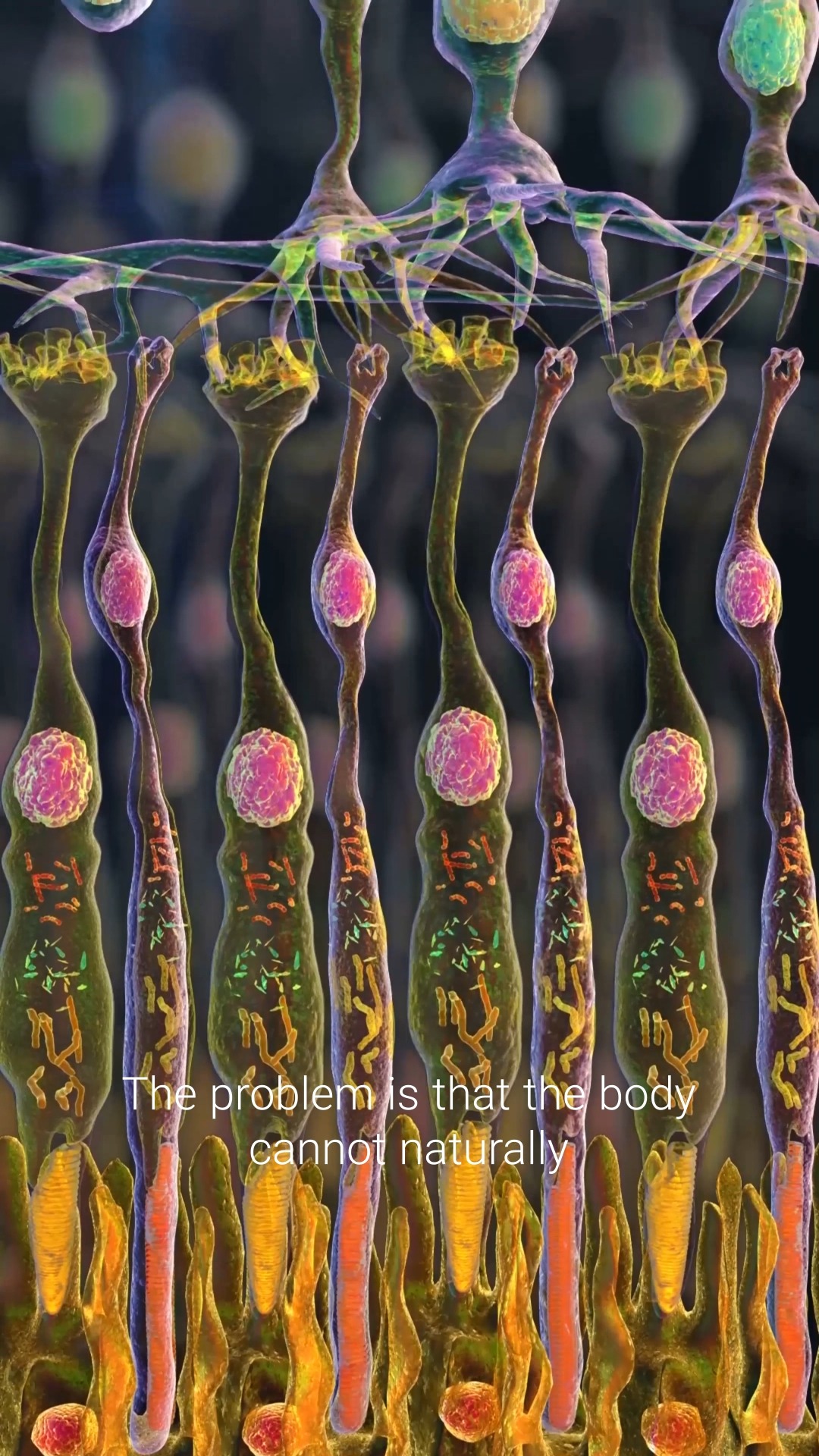 Do you know what happens when the cells in your retina become damaged ? 👁️
