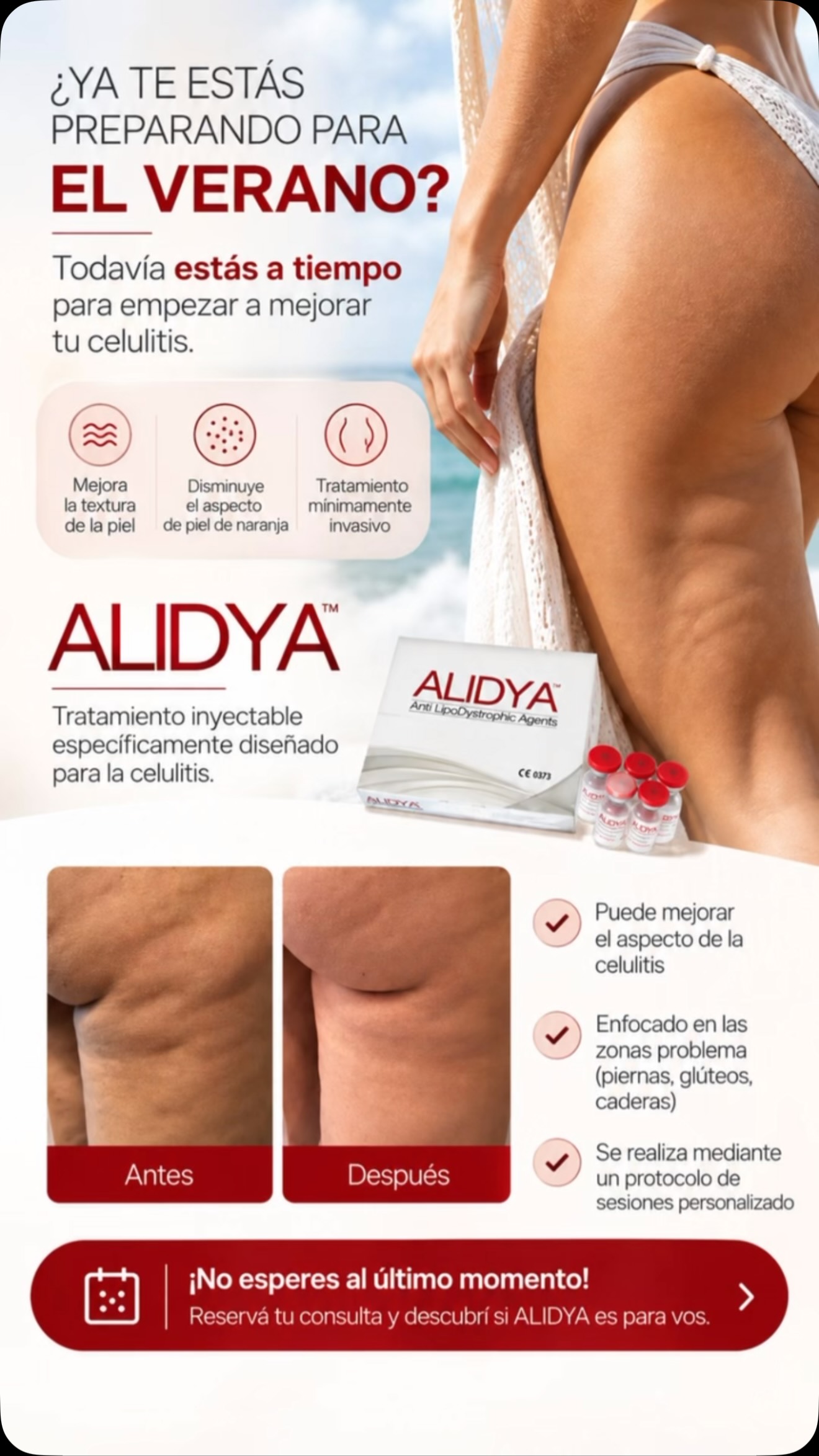 ☀️🔥 ¿YA TE ESTÁS PREPARANDO PARA EL VERANO? 👙
✨ ¡Todavía estás a tiempo de empezar a mejorar tu celulitis!
¿Te molesta la piel de naranja en piernas y glúteos? 🍊
💉 ALIDYA®️ es un tratamiento inyectable diseñado específicamente para abordar la celulitis y ayudar a mejorar el aspecto y la textura de la piel.
💎 ¿Por qué elegir ALIDYA?
✅ Tratamiento mínimamente invasivo.
✅ Enfocado en las zonas con celulitis.
✅ Puede mejorar la apariencia de la piel de naranja.
✅ Se realiza mediante un protocolo de sesiones personalizado.
🌸 El verano se acerca… ¡y el momento de empezar es AHORA!
Porque mejorar la celulitis lleva tiempo, constancia y un tratamiento adecuado para vos.
📲 ¡No esperes al último momento! Reservá tu consulta y descubrí si ALIDYA es para vos.
👩🏻⚕️ Dra. María Eugenia Buonsante
Dermatología y Estética
📩 Turnos por mensaje privado.
📍 Buenos Aires
📲 @drabuonsante
Los resultados pueden variar según cada paciente.
#Alidya #Celulitis #PielDeNaranja #DermatologíaEstética #TratamientosCorporales PreparadasParaElVerano DraBuonsante MedicinaEstética