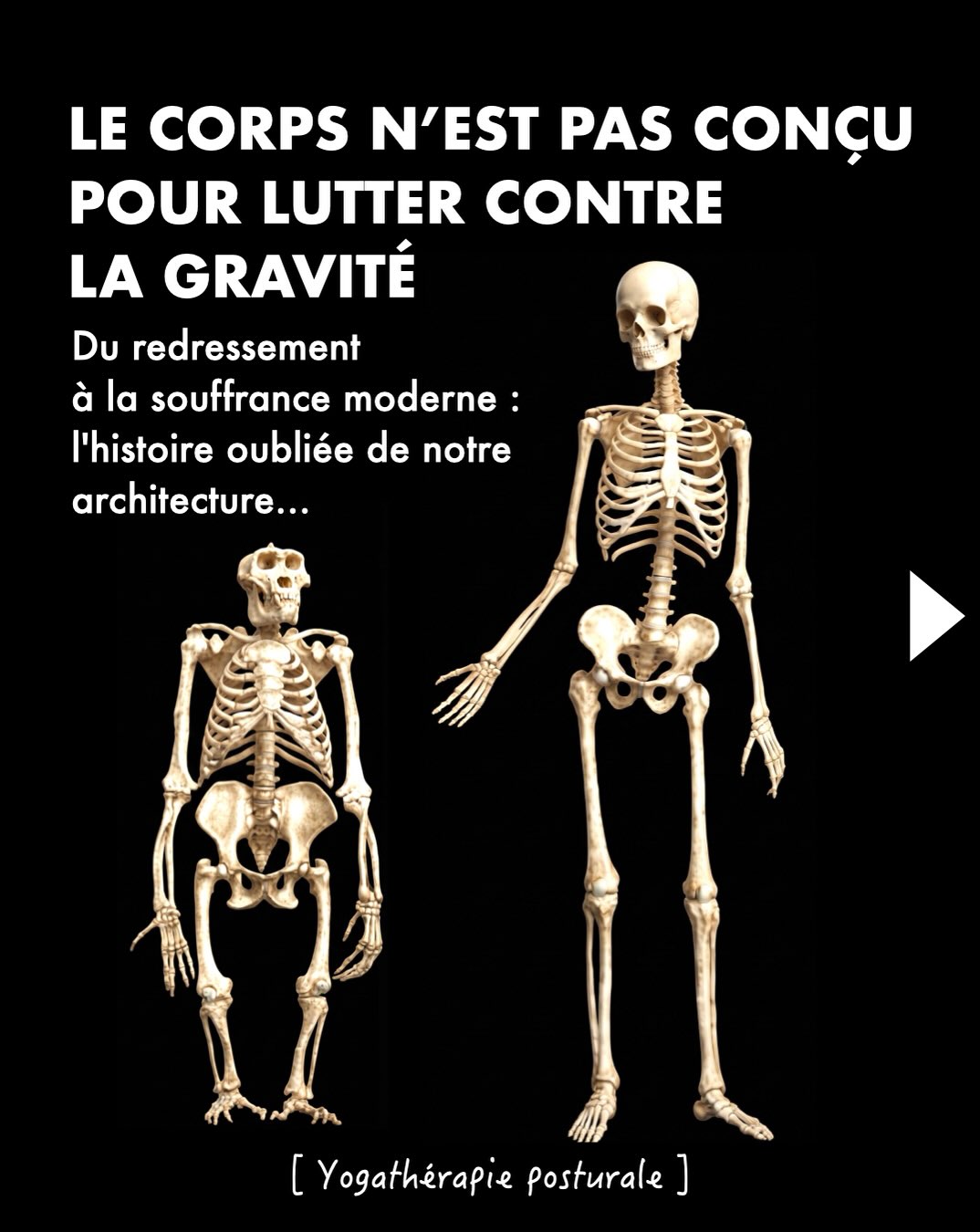 Votre colonne vertébrale n’est pas une anomalie bancale de l’évolution qui exigerait de vous contracter en permanence pour tenir debout. 🛑
Le passage de la quadrupédie au redressement vertical a sculpté une œuvre d’art d’ingénierie vivante : un plateau sacré naturellement incliné, une vertèbre L5 en trapèze taillée pour la charge et une cambrure basse qui amortit la vie. Notre squelette a été conçu pour être porté par la pesanteur, non pour lutter contre elle.
Alors comment sommes-nous devenus une civilisation où s’asseoir ou se tenir debout est une souffrance quotidienne ?
Au fil des décennies, nous avons troqué l’évidence de nos ancêtres contre :
👖 Des pantalons rigides qui verrouillent le pli de l’aine.
🛋️ Un mobilier ultra-moelleux qui avale notre bassin en rétroversion permanente.
❌ Des injonctions absurdes (« rentre le ventre », « serre les fesses ») qui multiplient la charge sur vos disques jusqu’à +200 % selon les mesures du Pr Nachemson.
Pour libérer son dos, il ne faut pas se redresser par la force : il faut réveiller la chaîne ascendante du squelette, depuis l’hélice de nos pieds jusqu’à la suspension naturelle du bassin.
🌿 Sur notre blog, nous venons de publier une grande fresque de 19 minutes : une plongée anthropologique, anatomique et clinique au cœur de la perte de notre aplomb, accompagnée du « Test du Mur » pour tester votre propre axe chez vous.
💬 Commentez simplement « FRESQUE » sous cette publication : nous vous envoyons directement le lien d’accès en message privé pour plonger dans le dossier complet !
✉️👇
#Yogatherapie #biomecanique #Posturo #YogaAnatomie #cathetsergeyoga