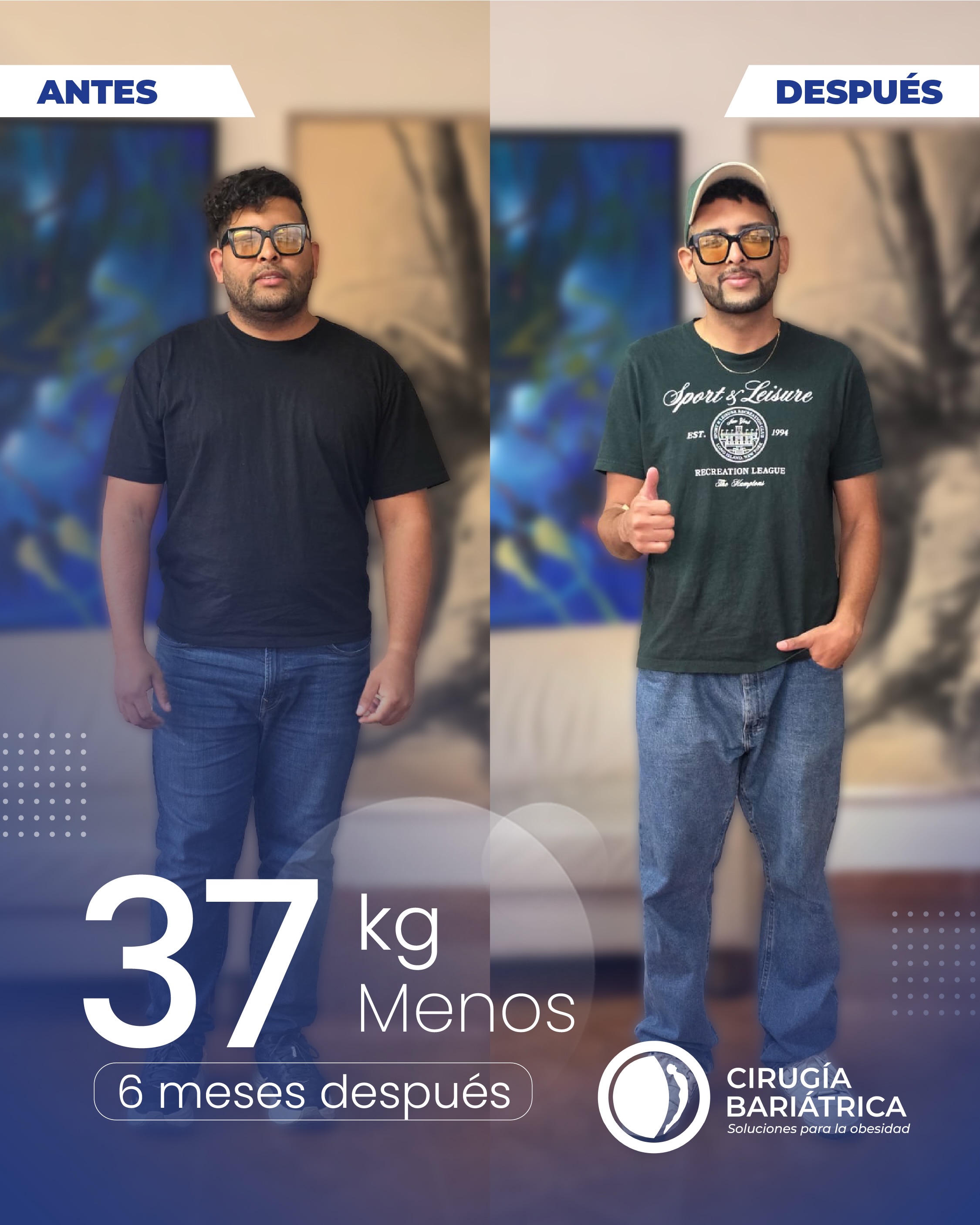 Resultados que hablan por sí solos: 37!kilos menos en solo 6 meses.👏✨
La cirugía bariátrica del Dr. Bolaños y su equipo está diseñada para lograr excelentes resultados y mejorar la calidad de vida de cada paciente, con tecnología, experiencia y compromiso.🌻
Contactos: +57 3155659167 | +57 3152887610 | Inglés o español ✅
#CirugíaBariátrica #Transformación #beauty